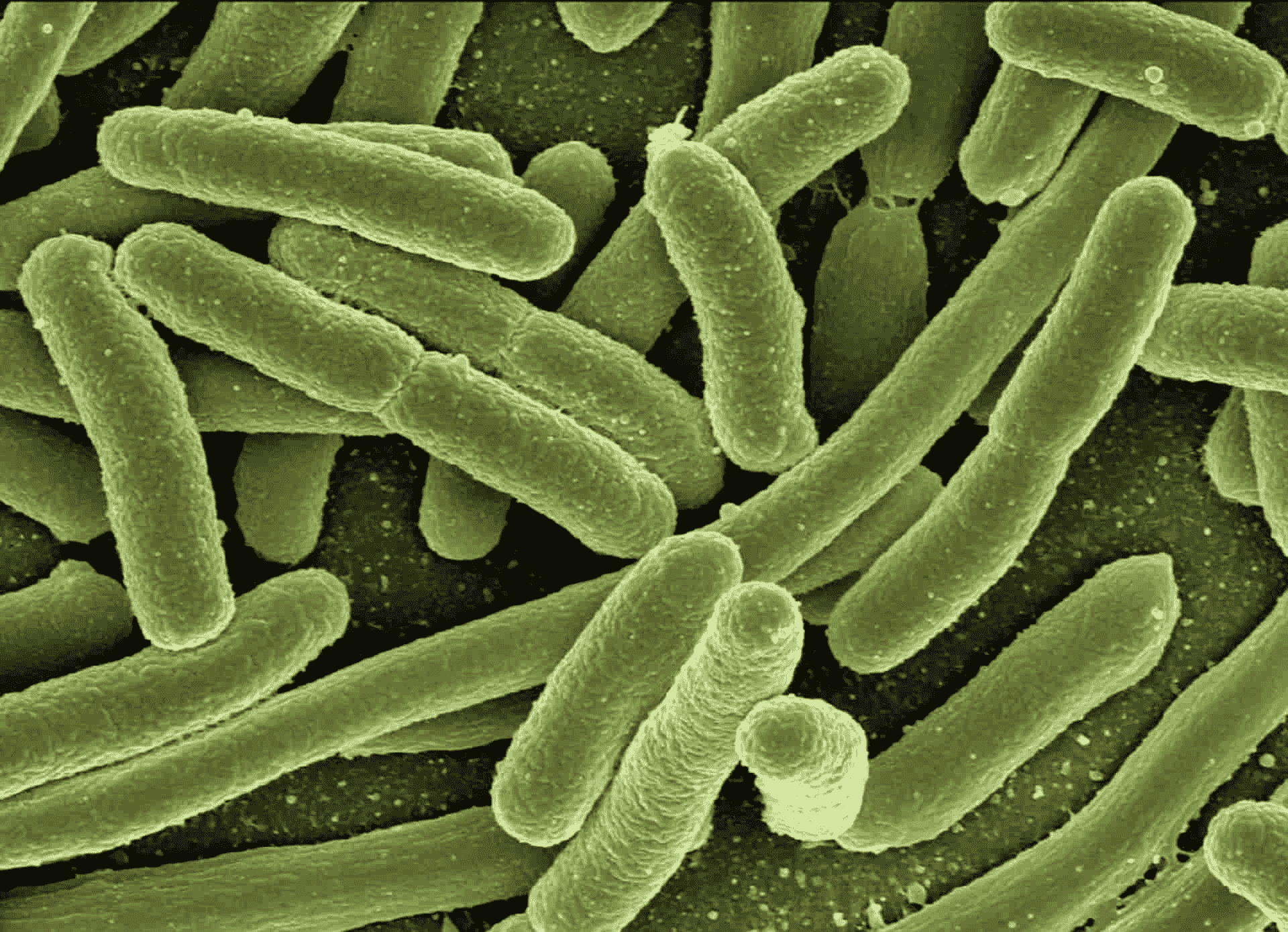 Prokaryotes