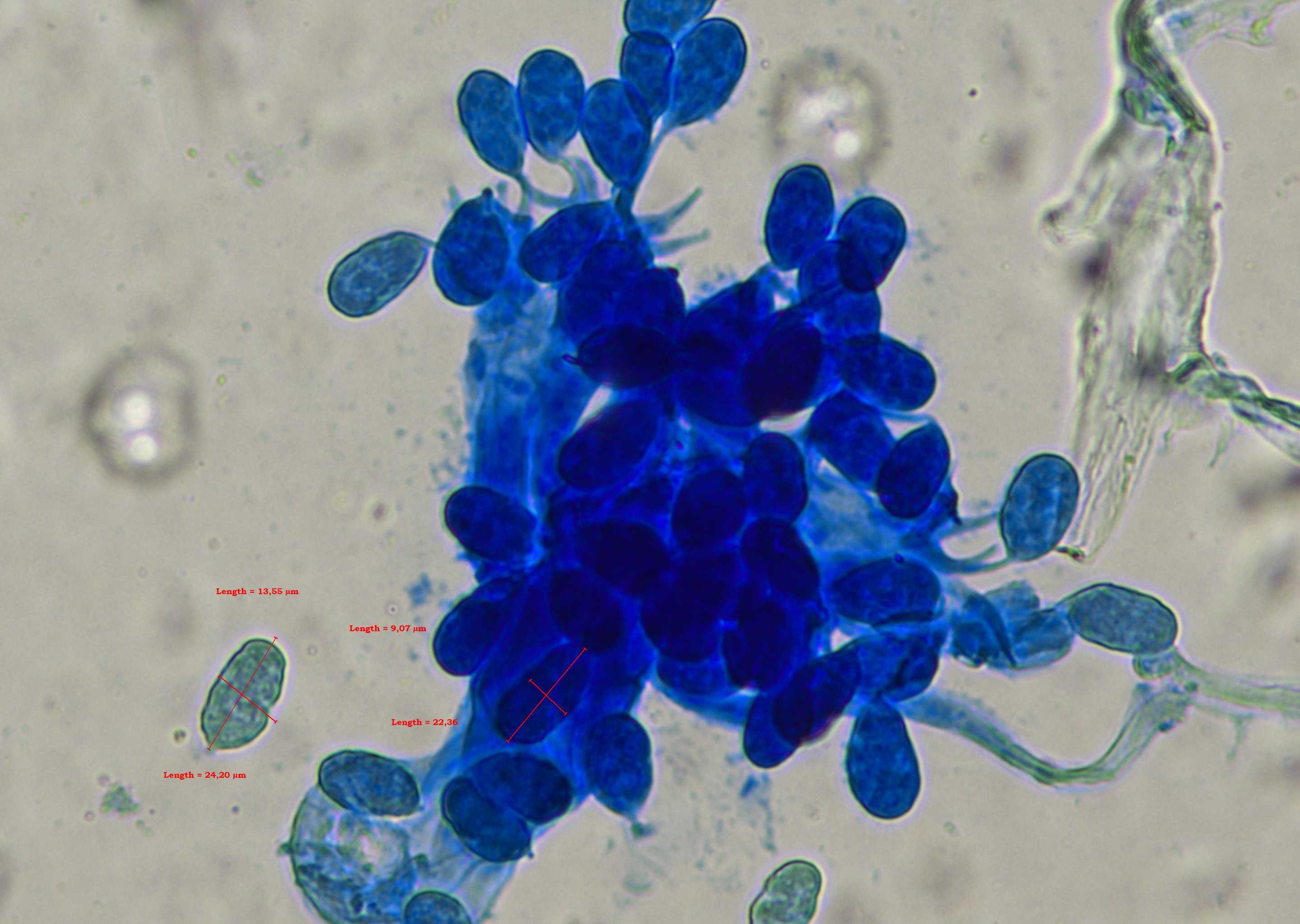 Peronosclerospora philippinensis