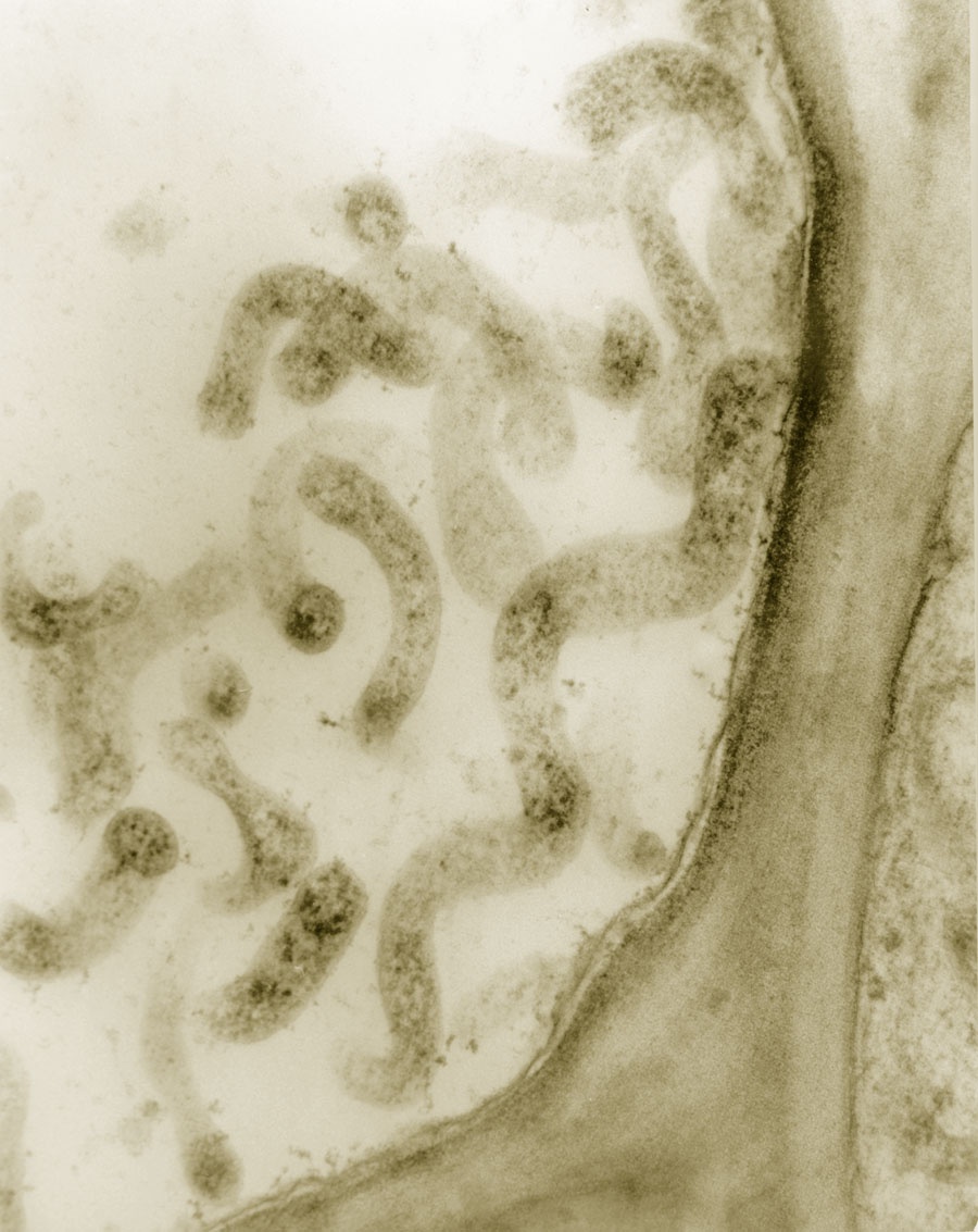 Spiroplasma kunkelii