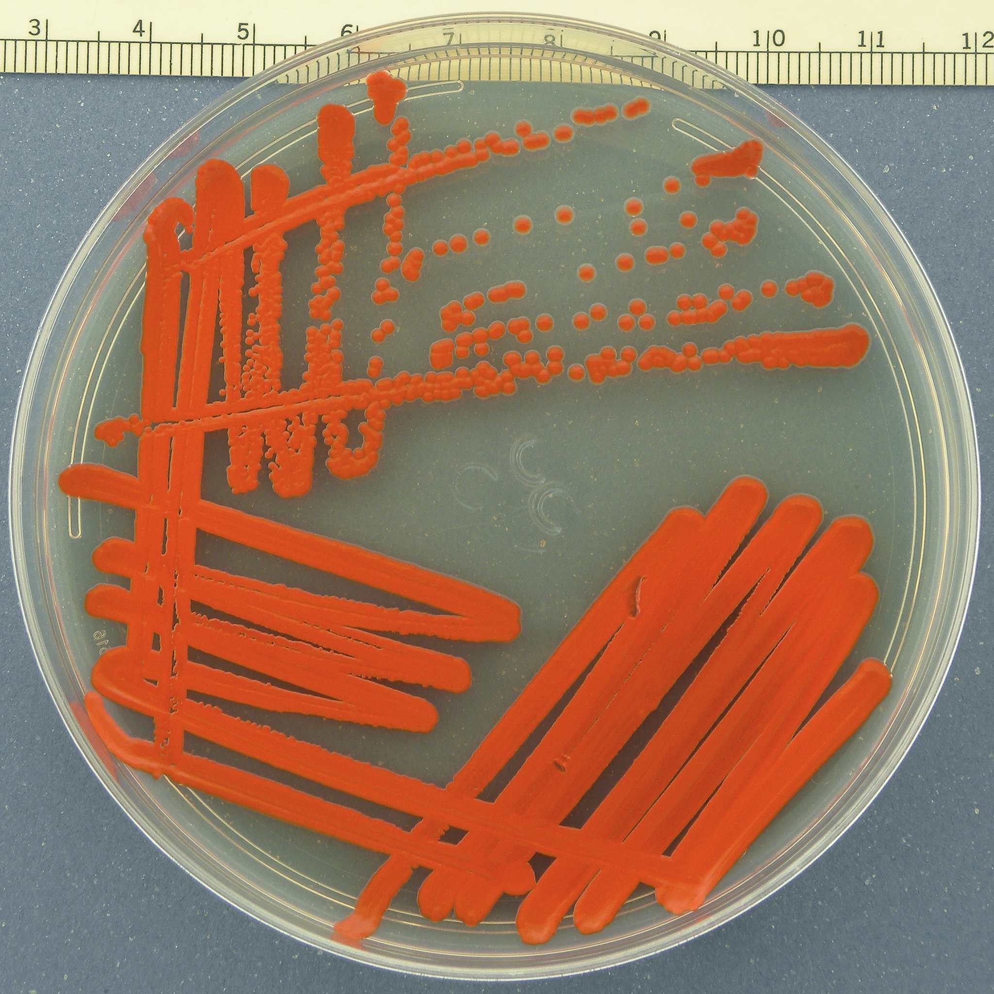 Serratia marcescens