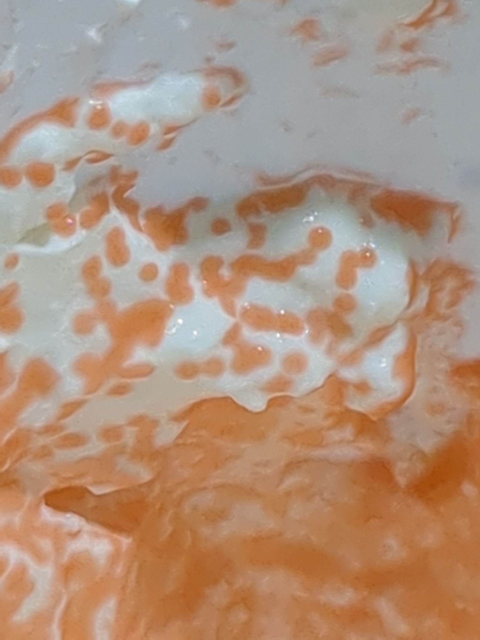 Serratia marcescens