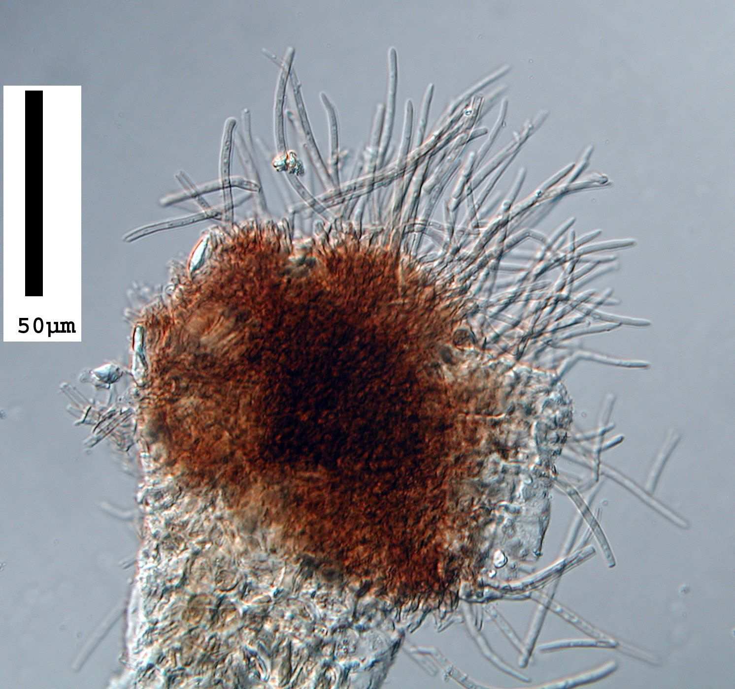 Pseudocercospora rubi
