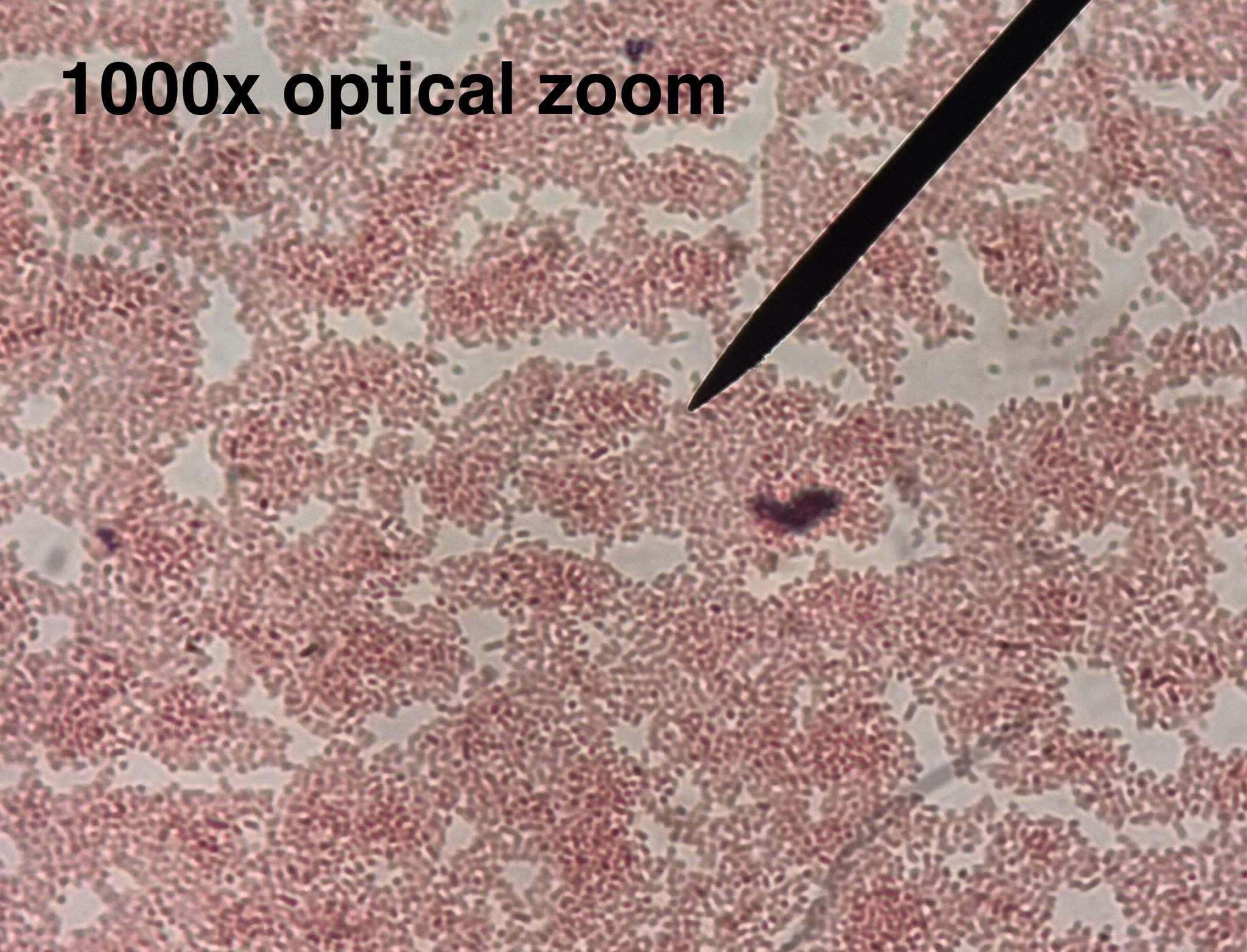 Pectobacterium carotovorum