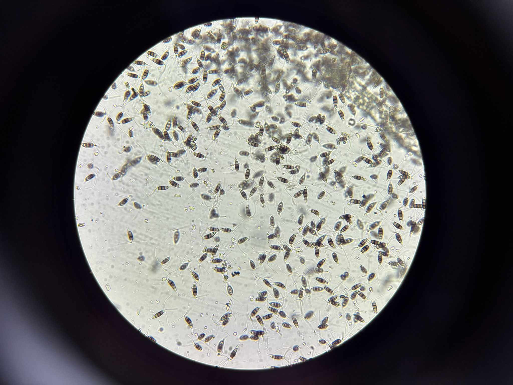 Pestalotiopsis psidii