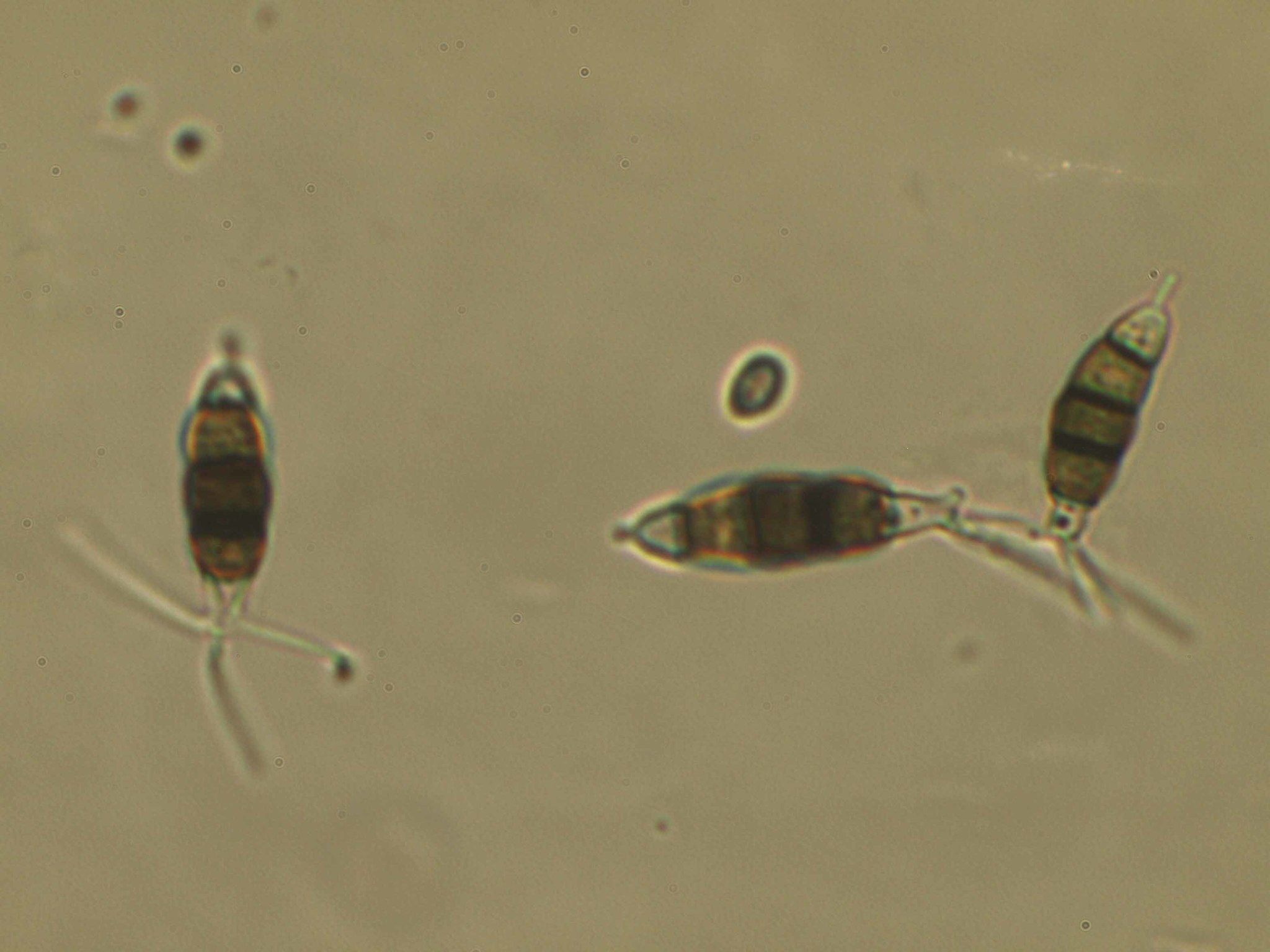 Pestalotiopsis psidii