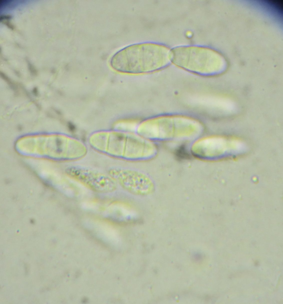 Fusarium sambucinum