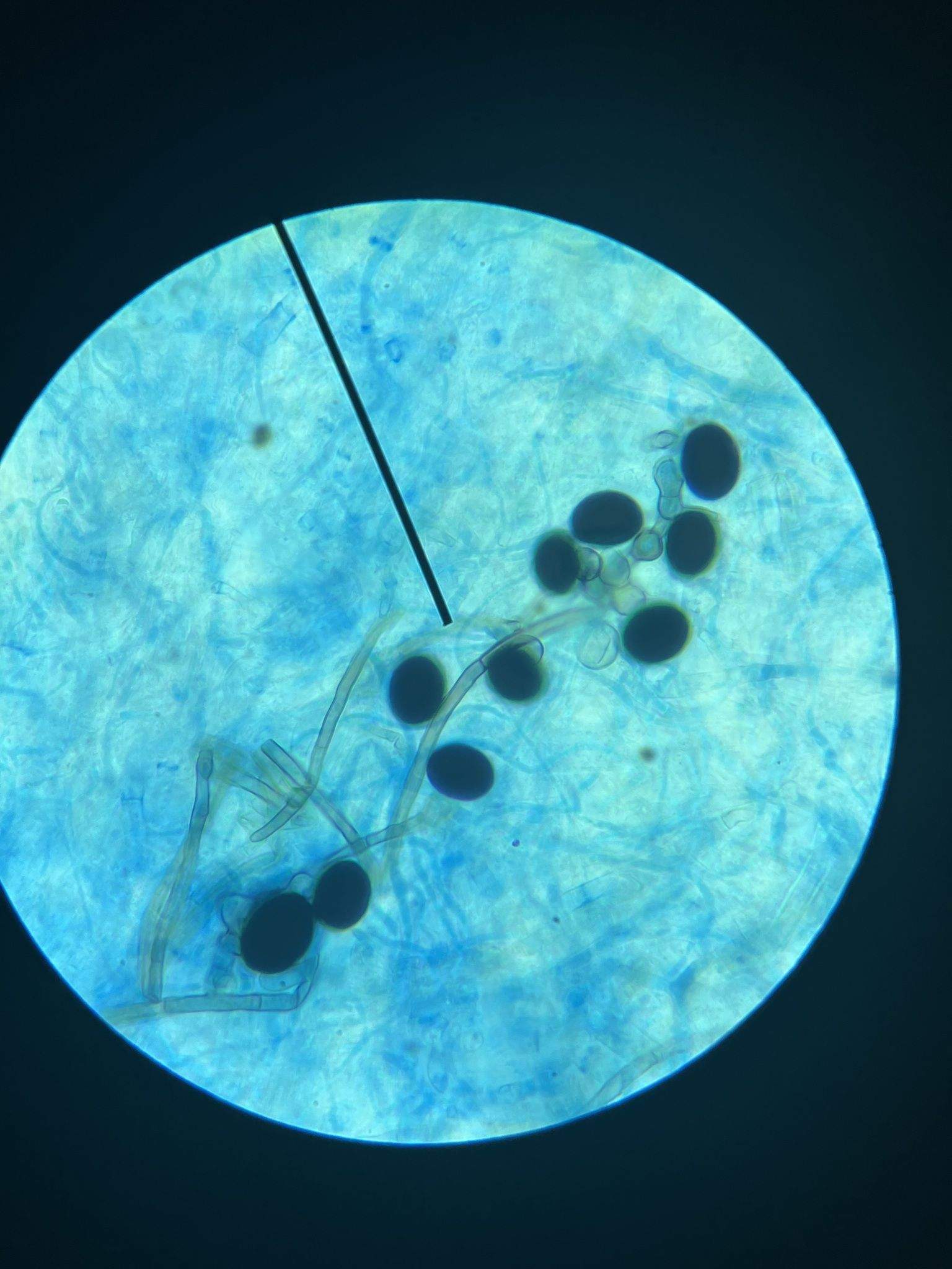 Nigrospora oryzae