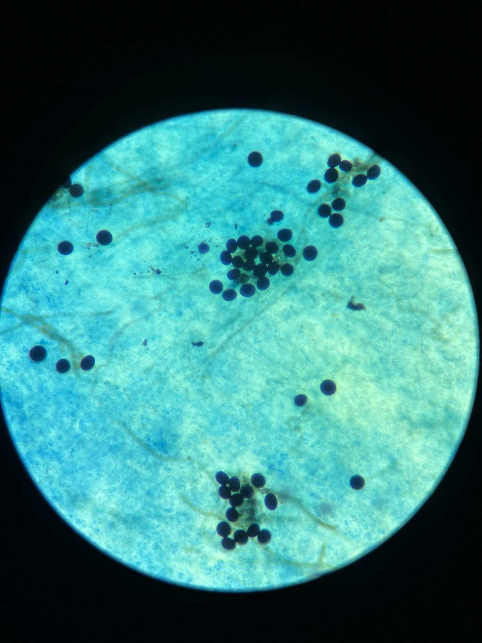 Nigrospora oryzae