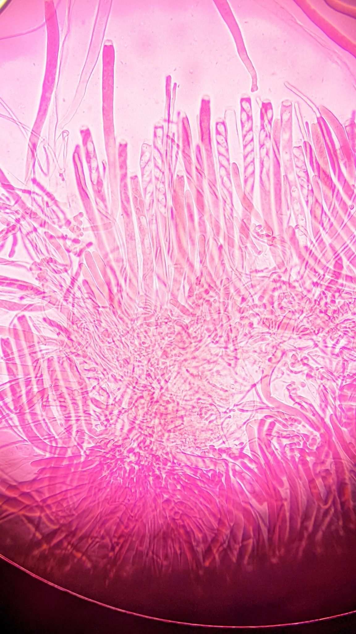 Ciborinia camelliae
