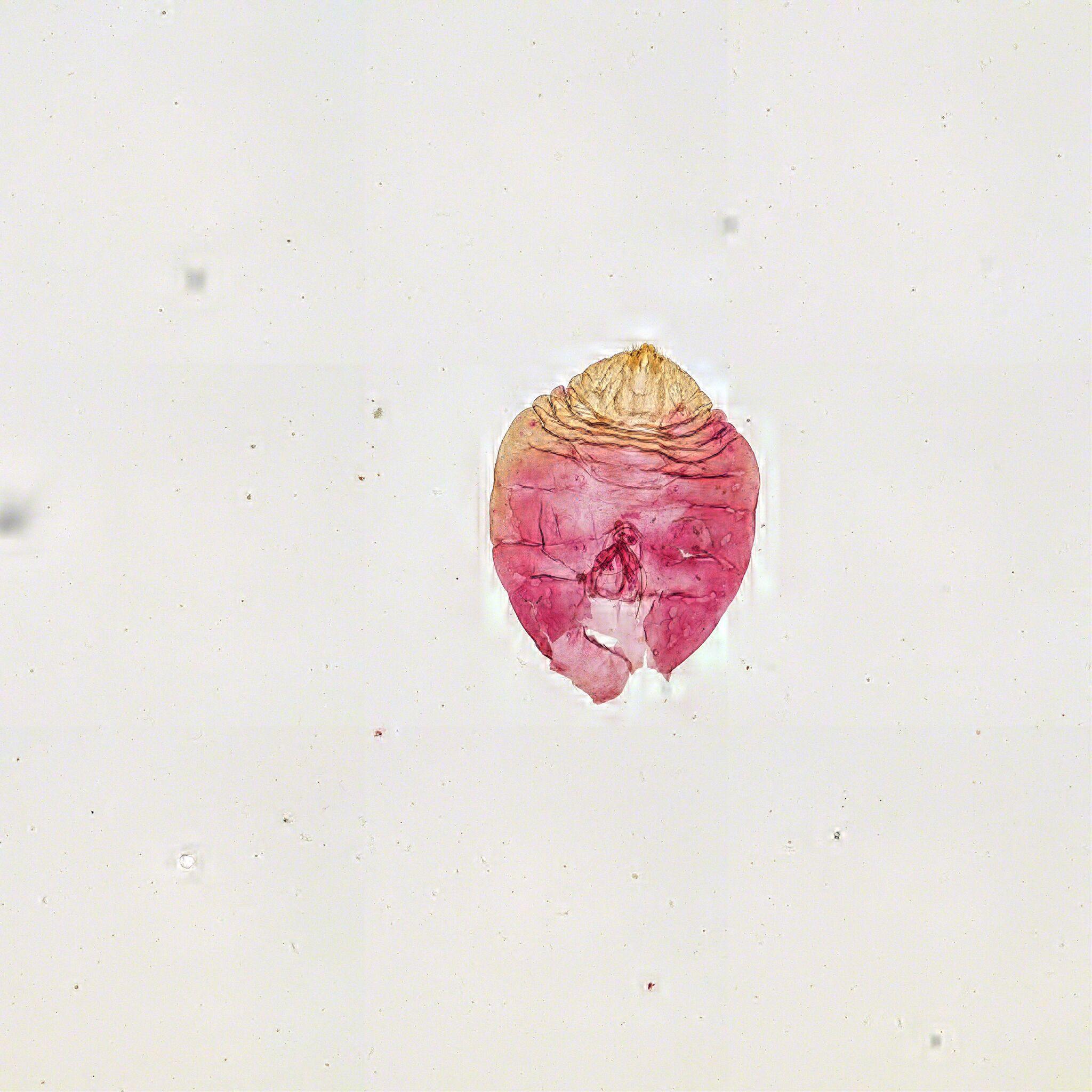 Hemiberlesia lataniae
