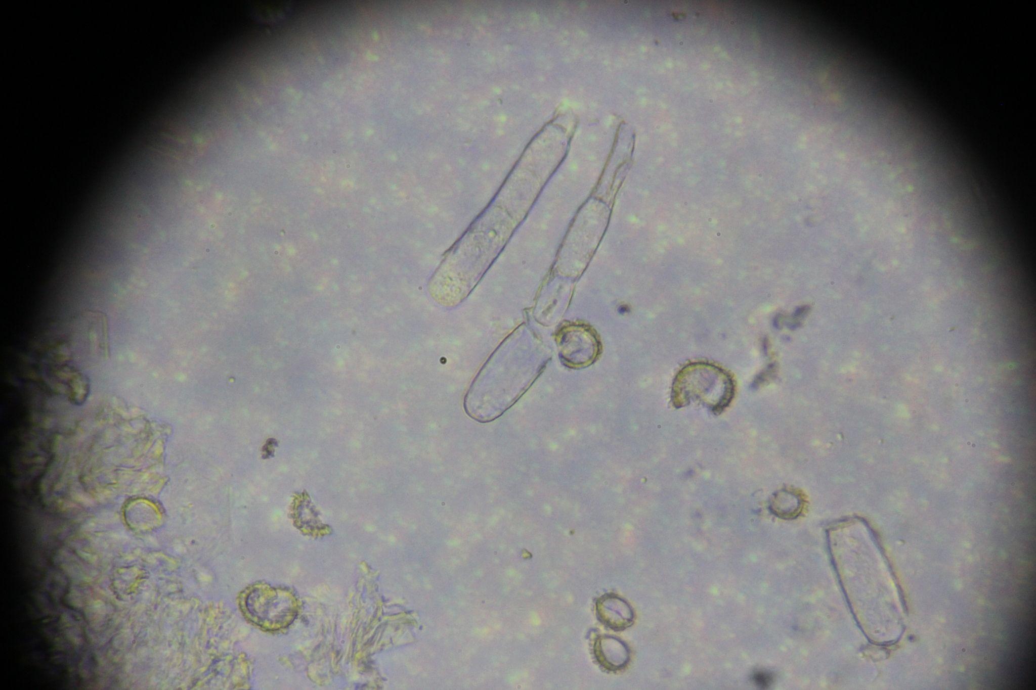 Erysiphe australiana