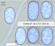 Golovinomyces orontii