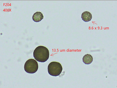 Sporisorium reilianum