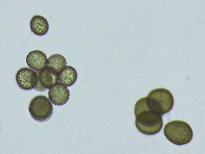 Sporisorium reilianum