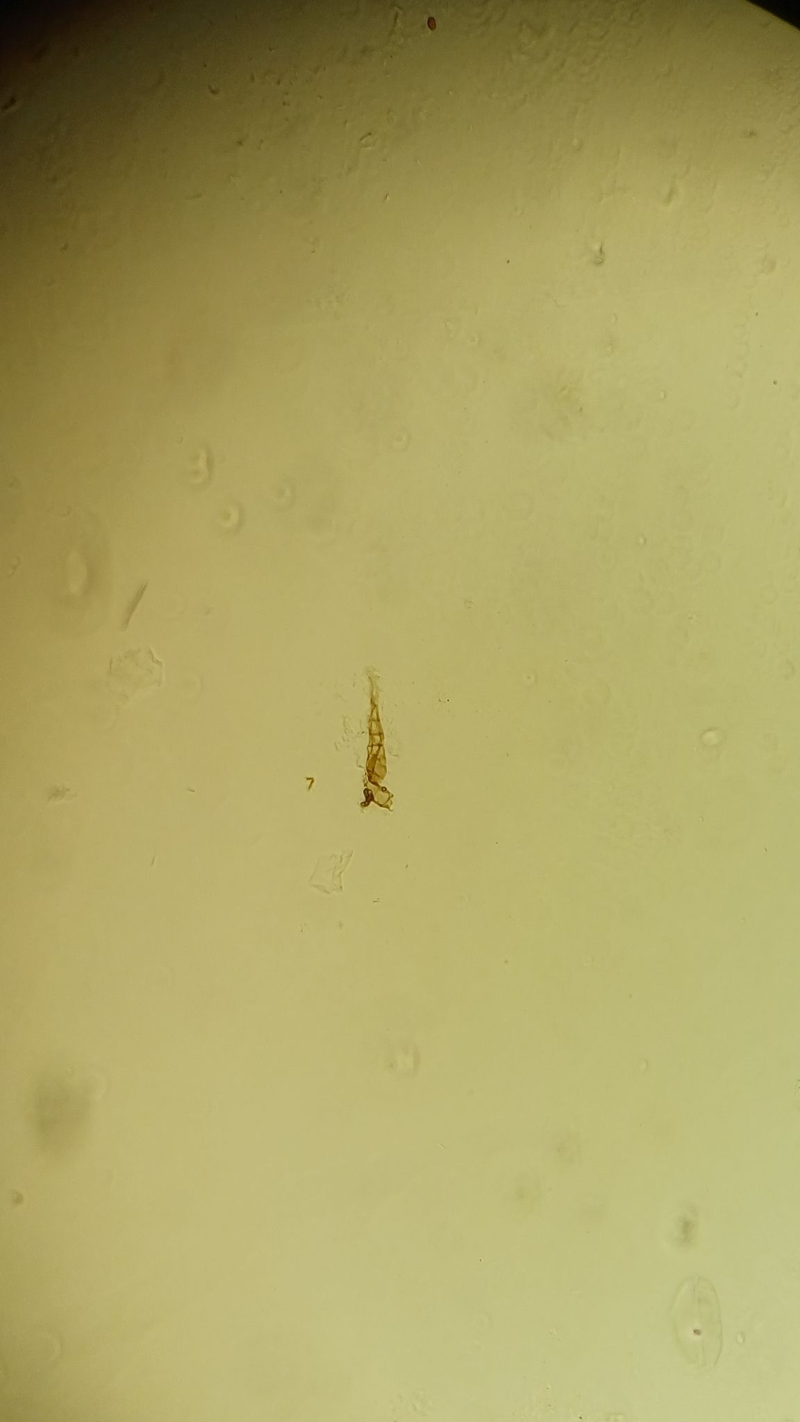 Alternaria dianthicola