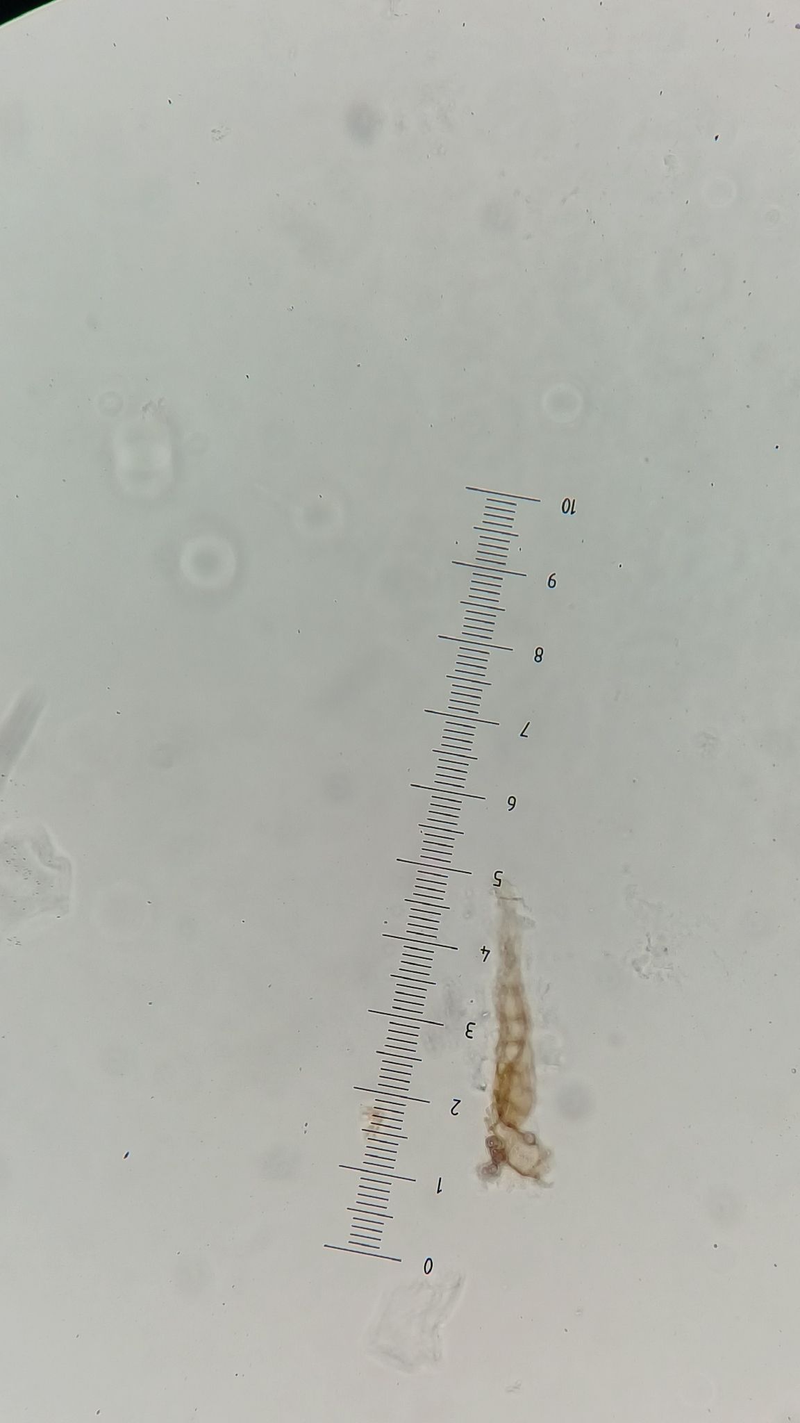 Alternaria dianthicola