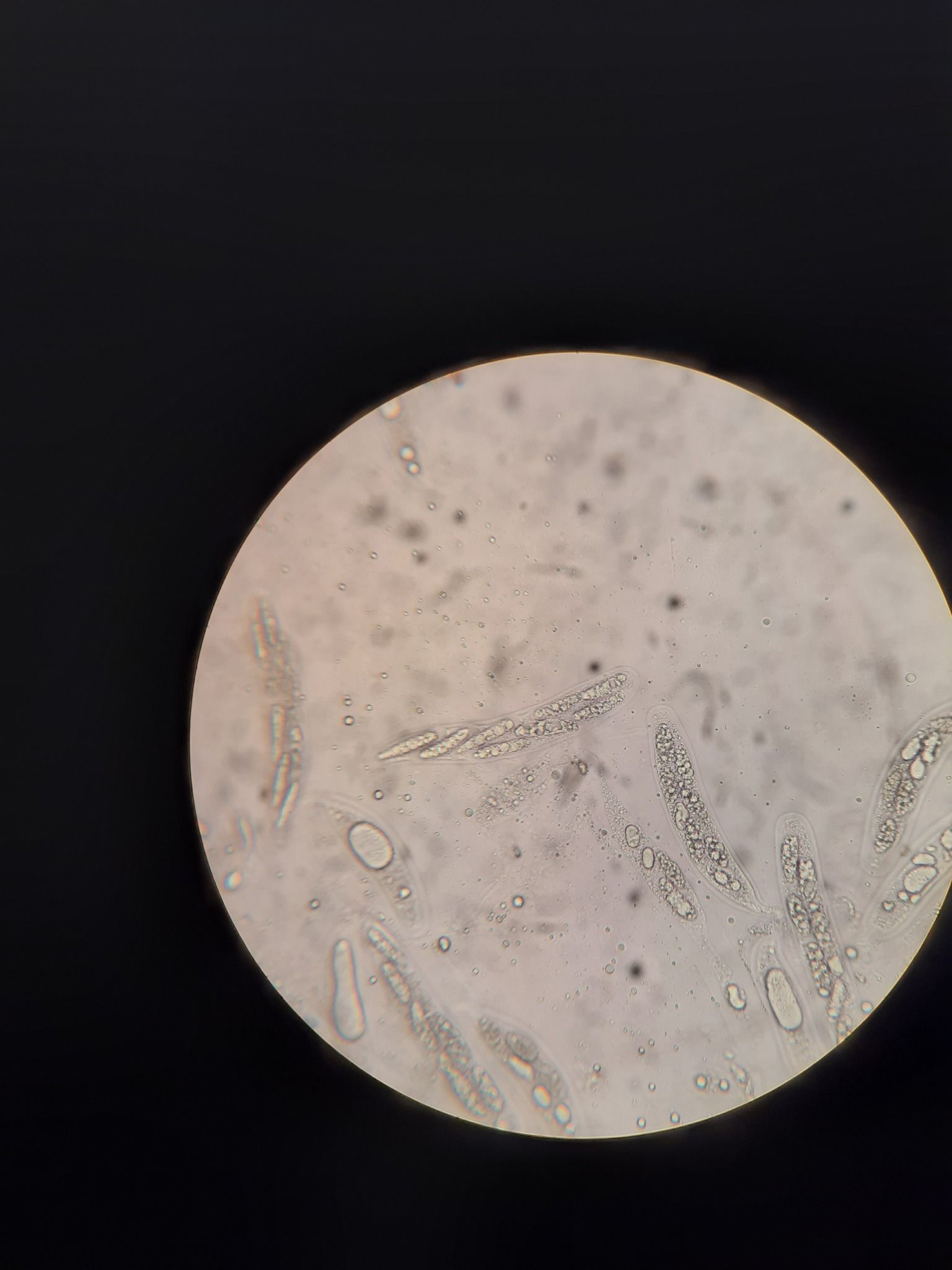 Stilbospora