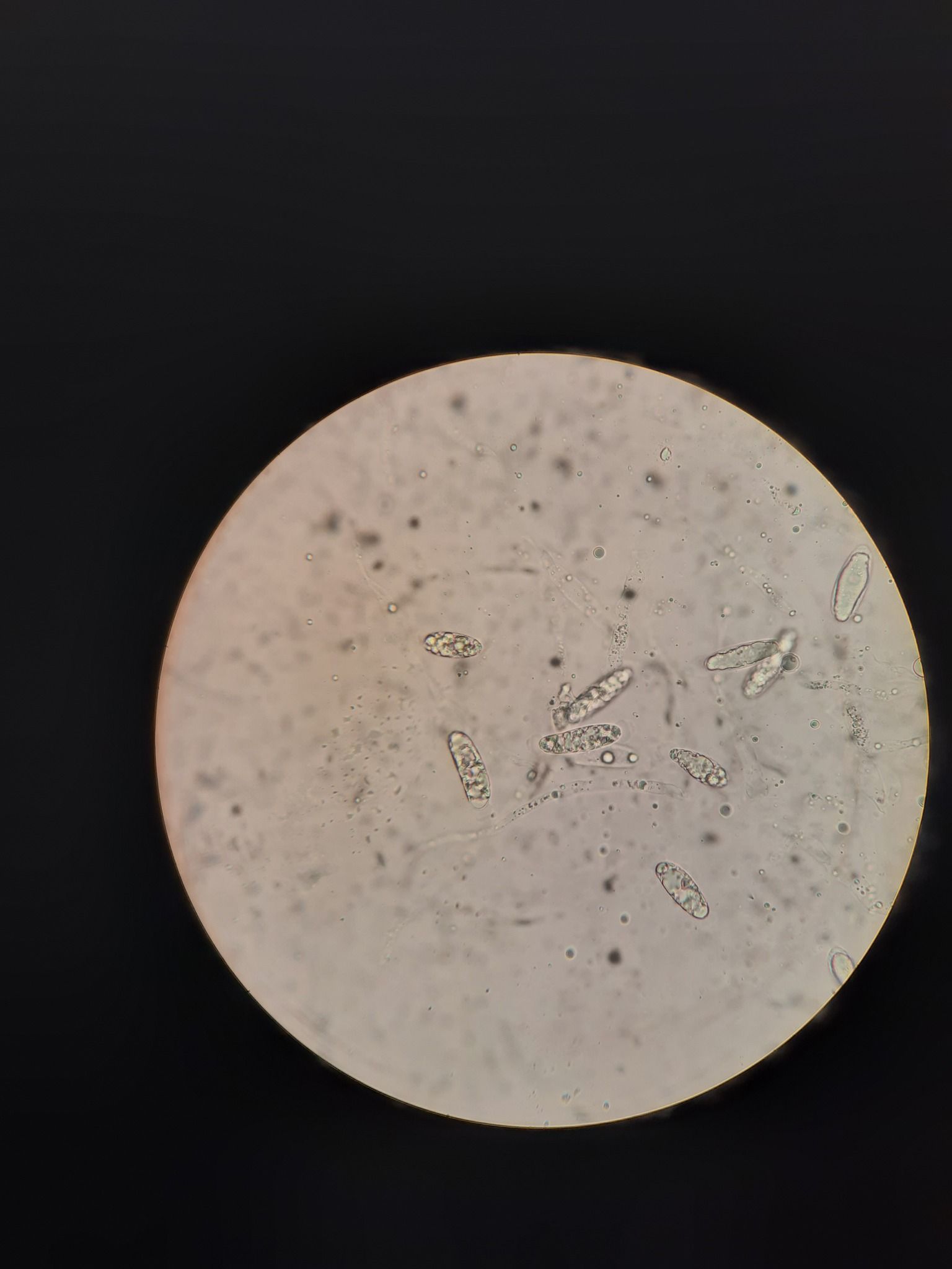 Stilbospora