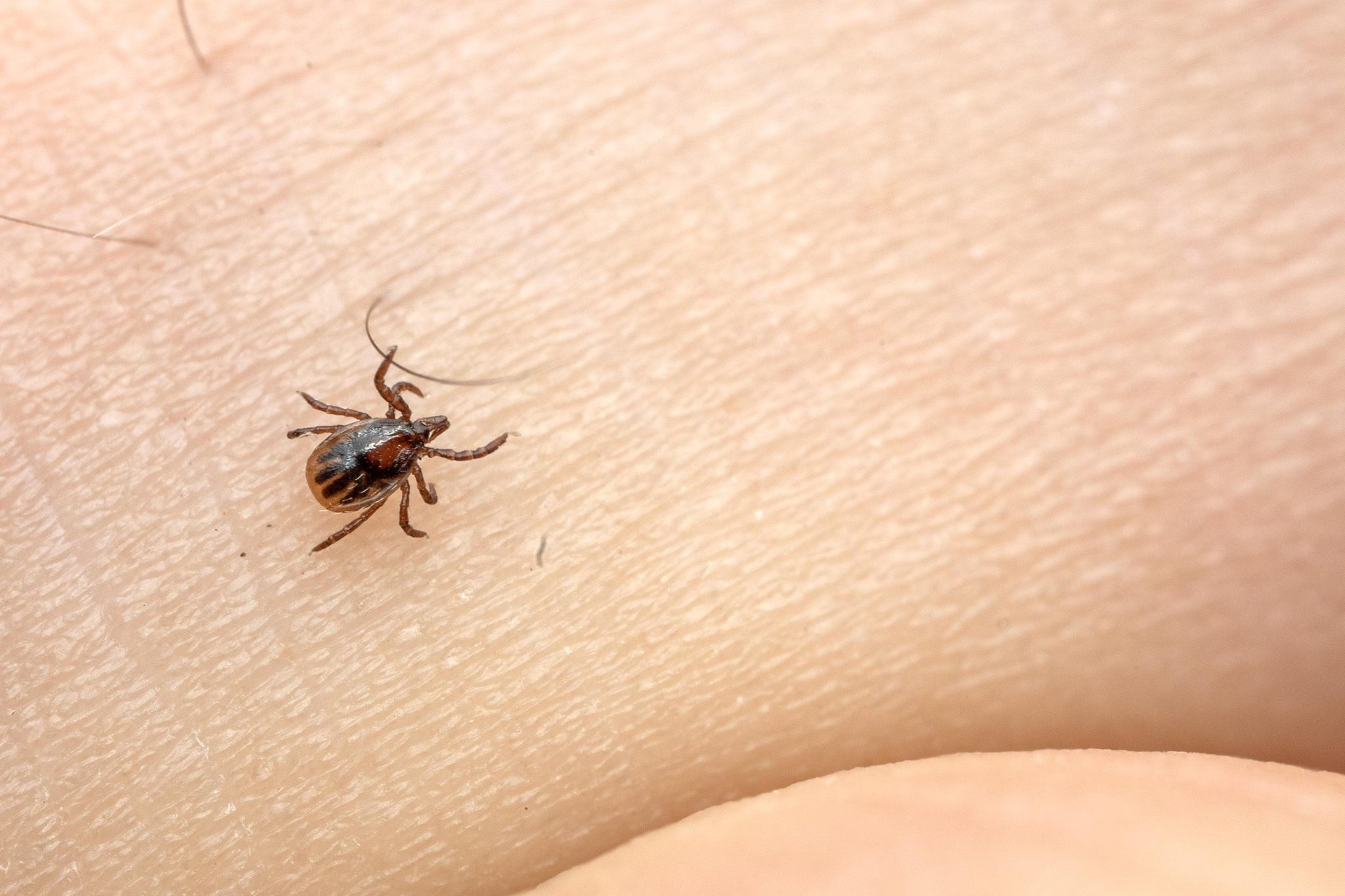 Ixodes ricinus