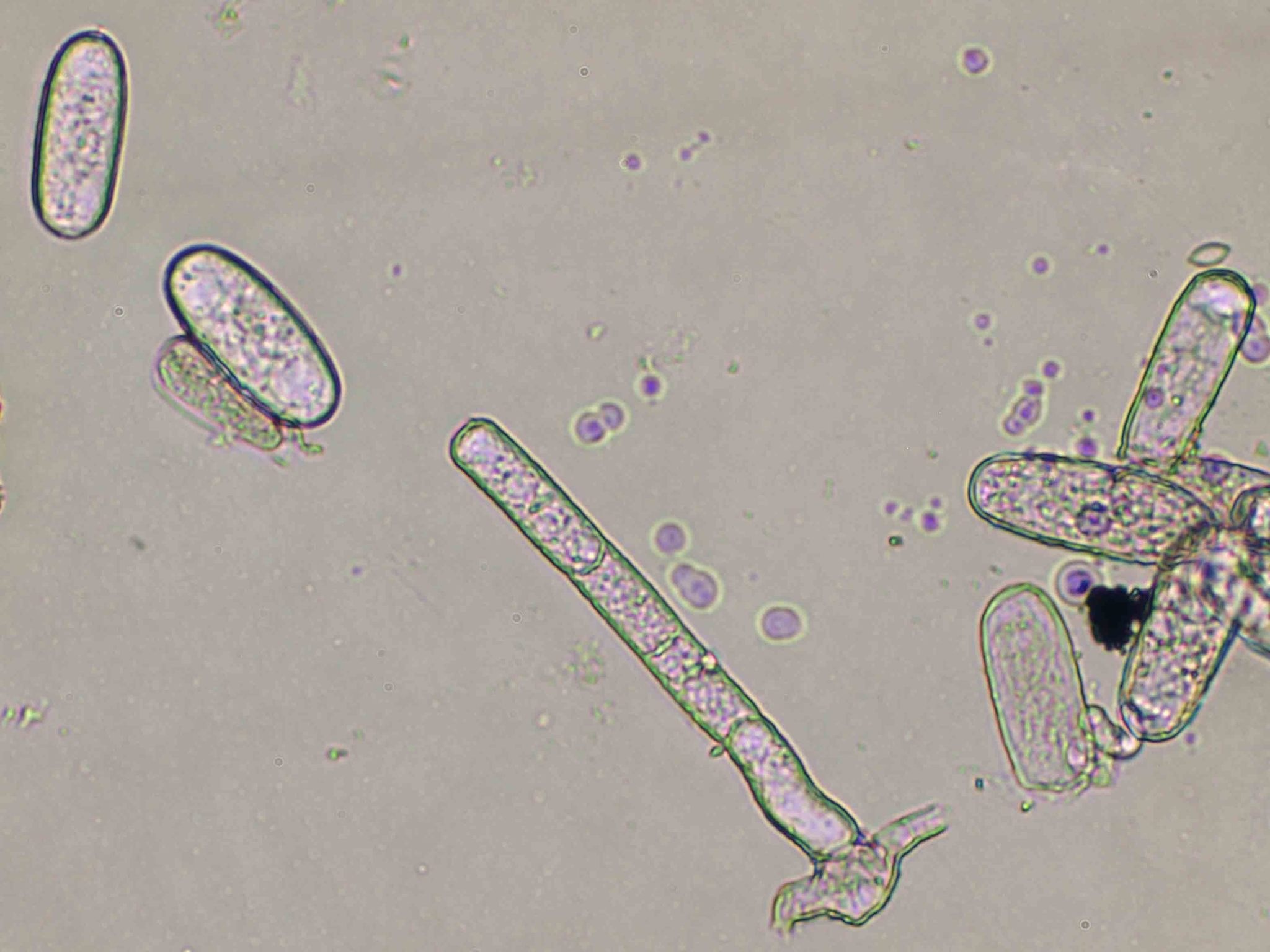 Erysiphe necator