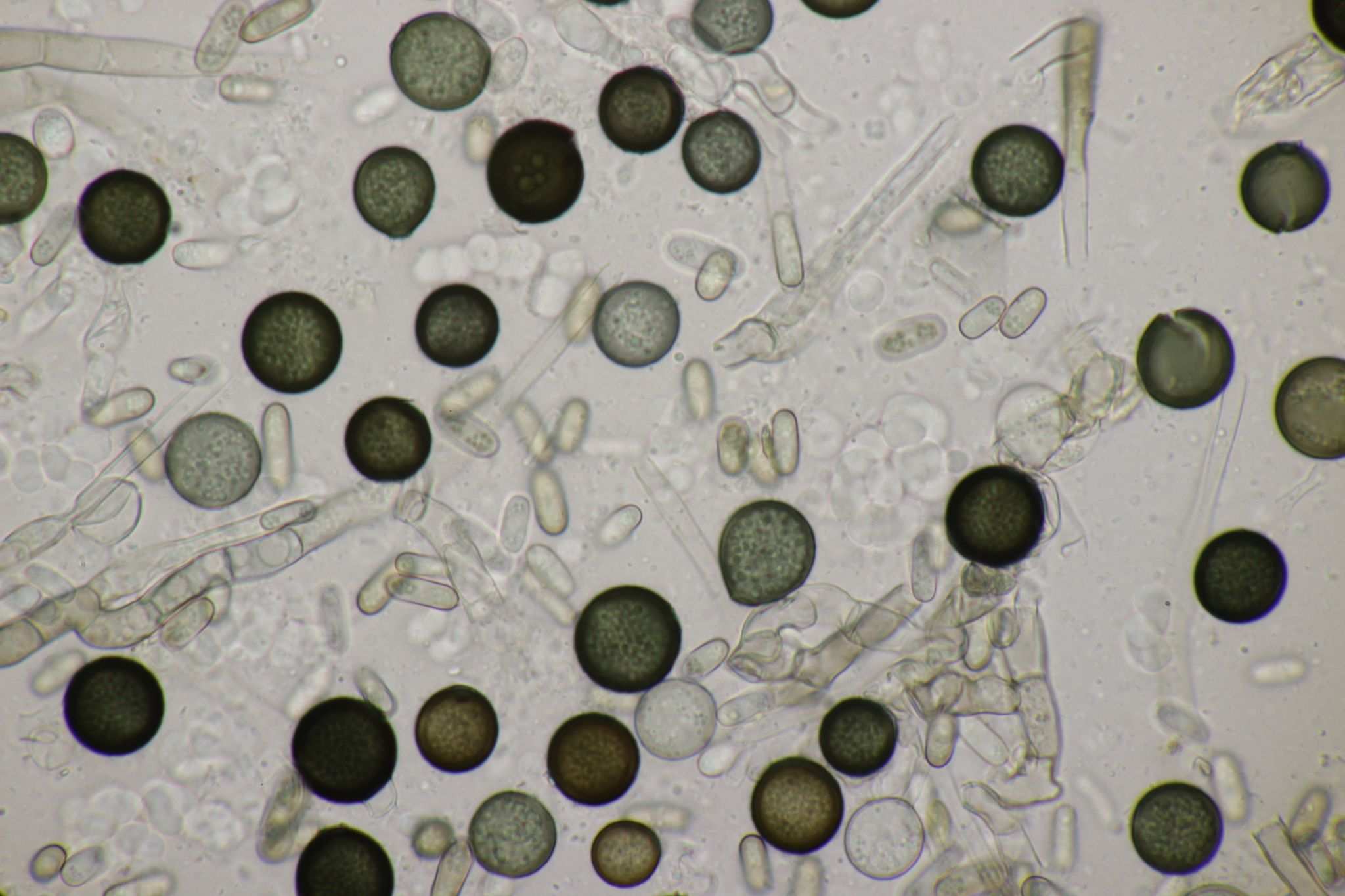 Thielaviopsis paradoxa