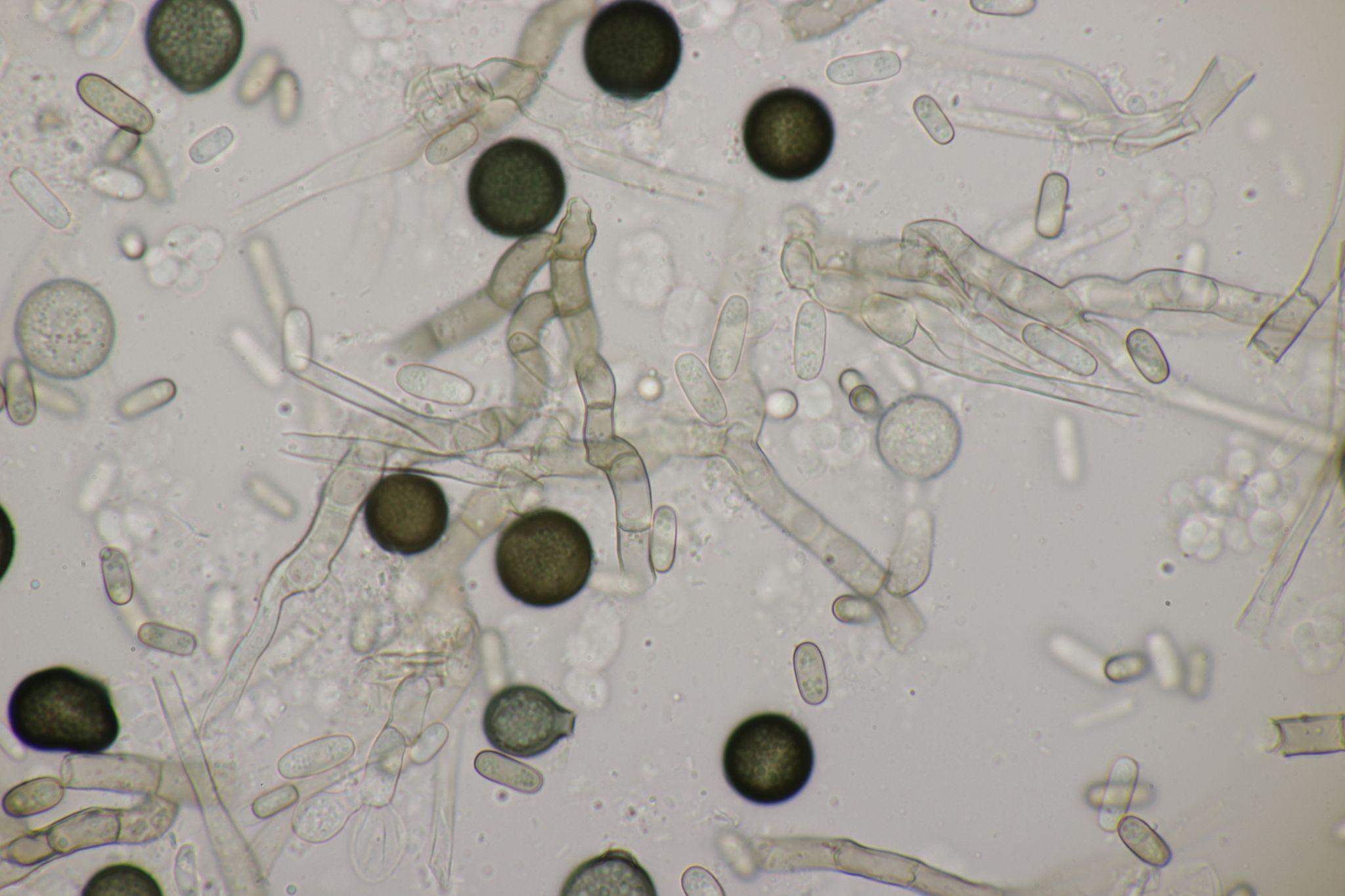 Thielaviopsis paradoxa