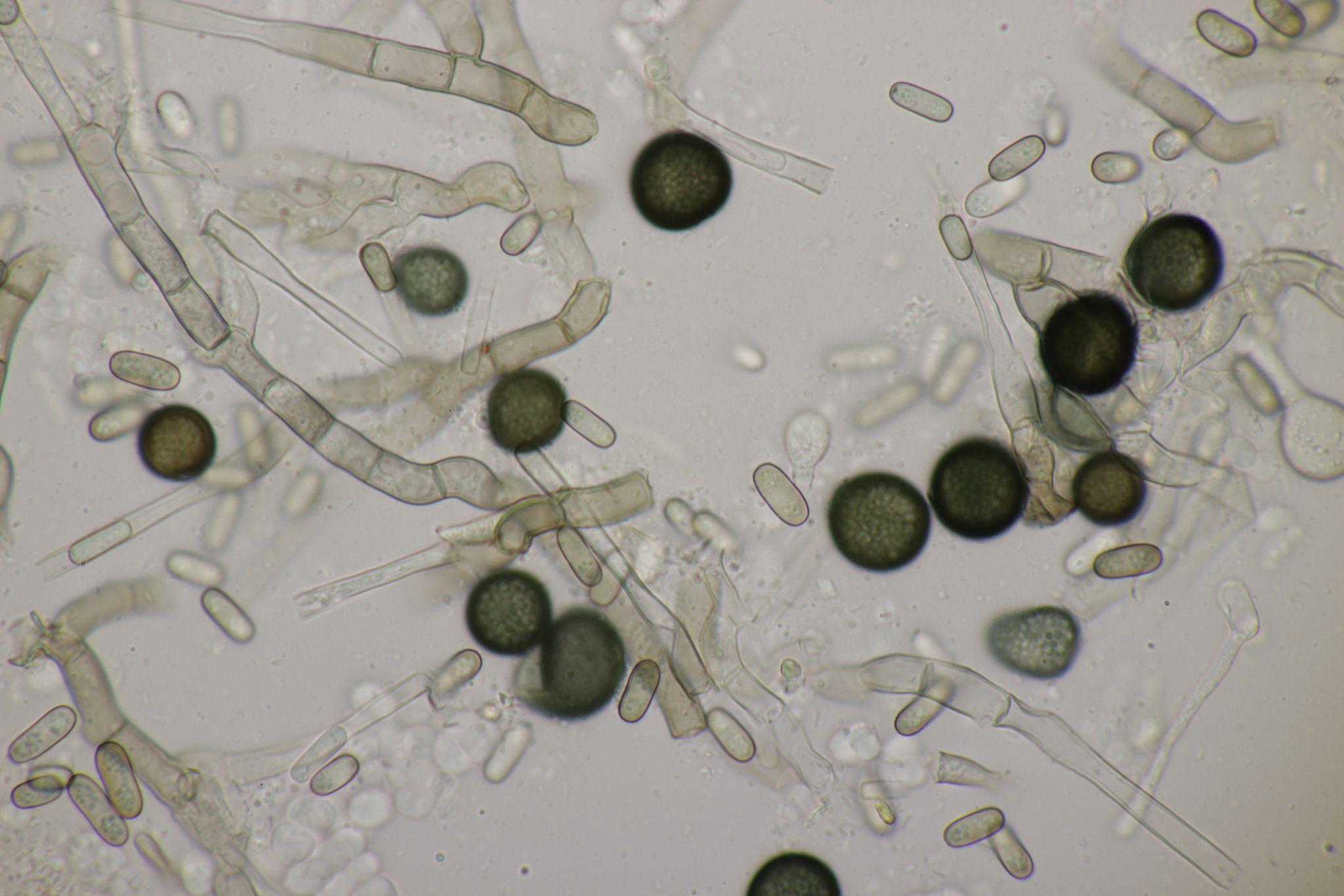 Thielaviopsis paradoxa