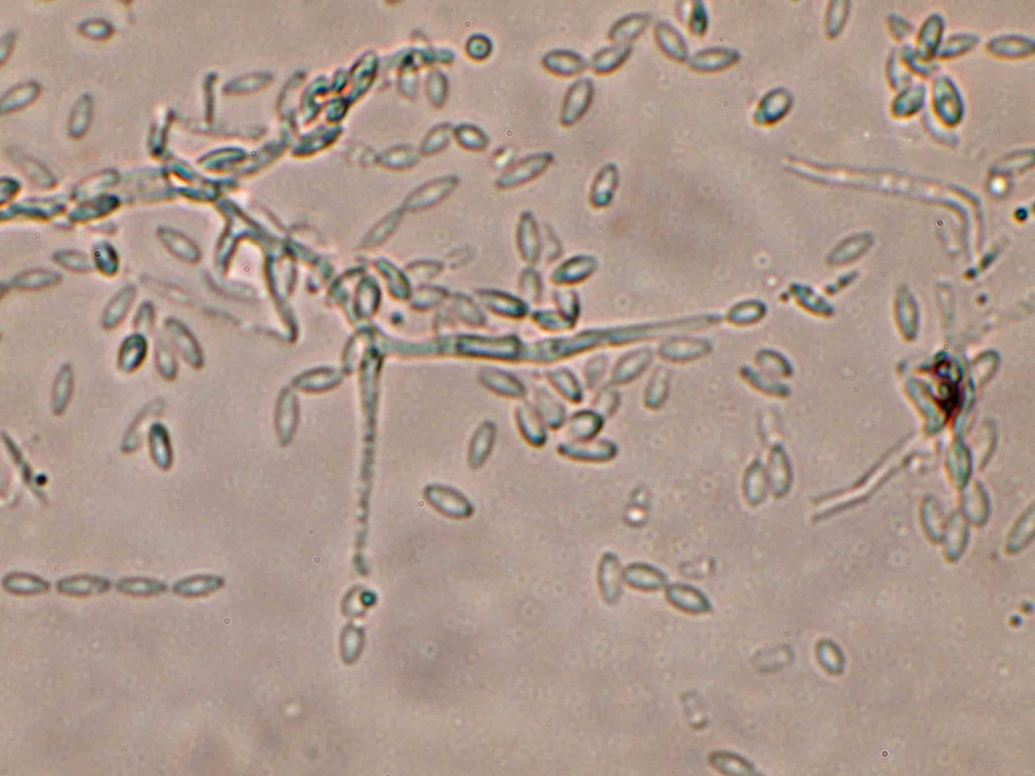 Thielaviopsis paradoxa