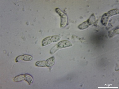 Diplocarpon earlianum