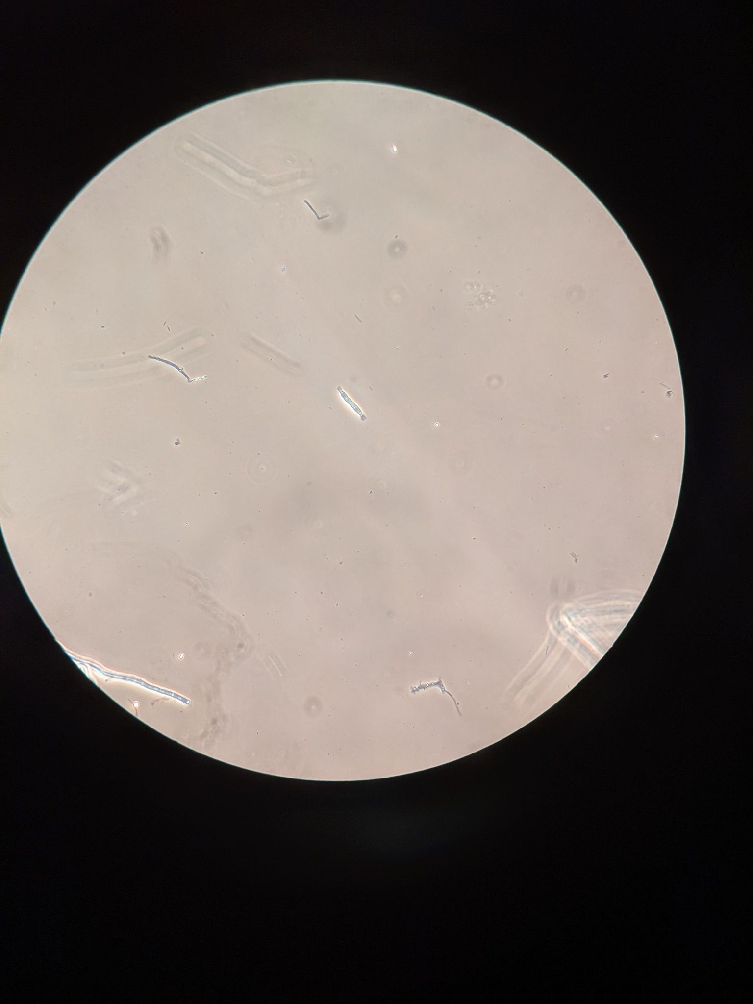 Fusarium tricinctum