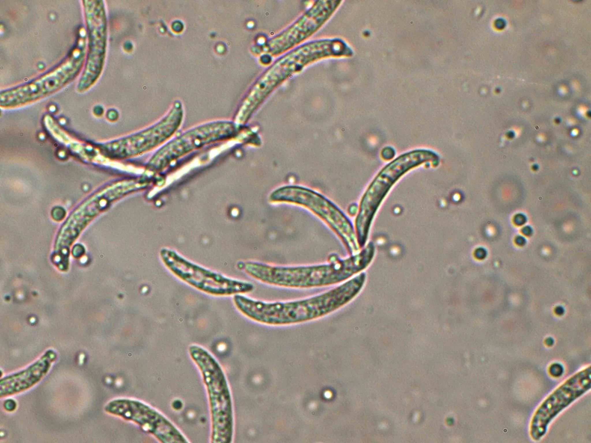 Colletotrichum truncatum