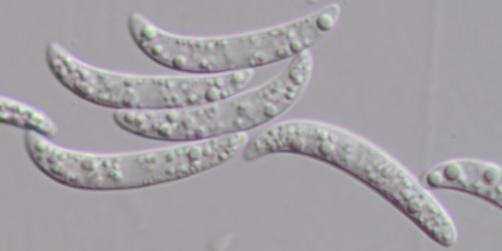 Colletotrichum truncatum