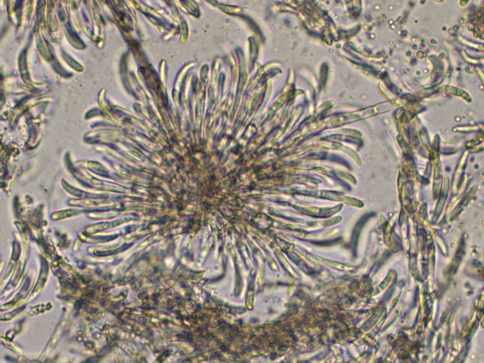 Colletotrichum truncatum