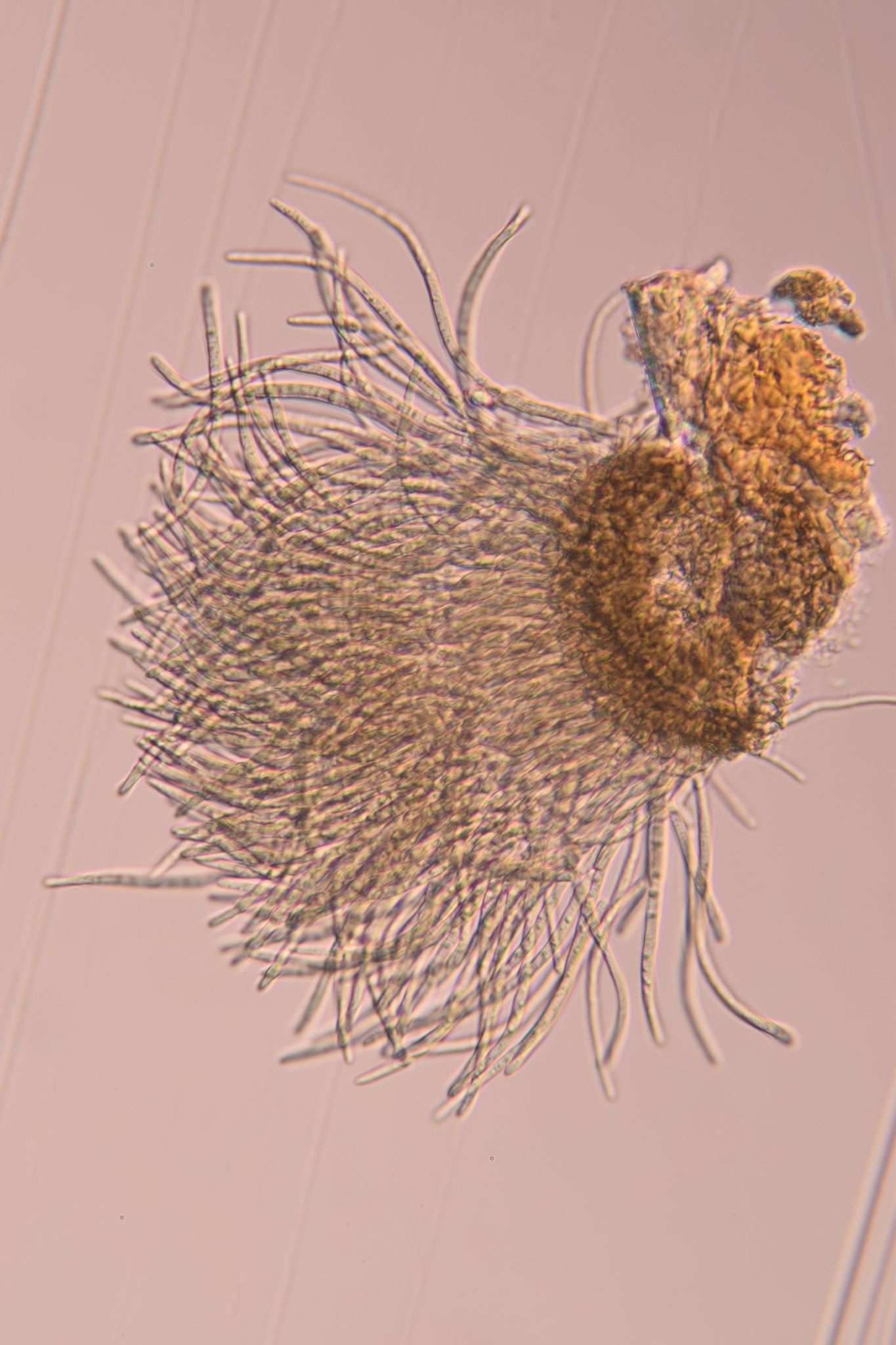 Pseudocercospora theae