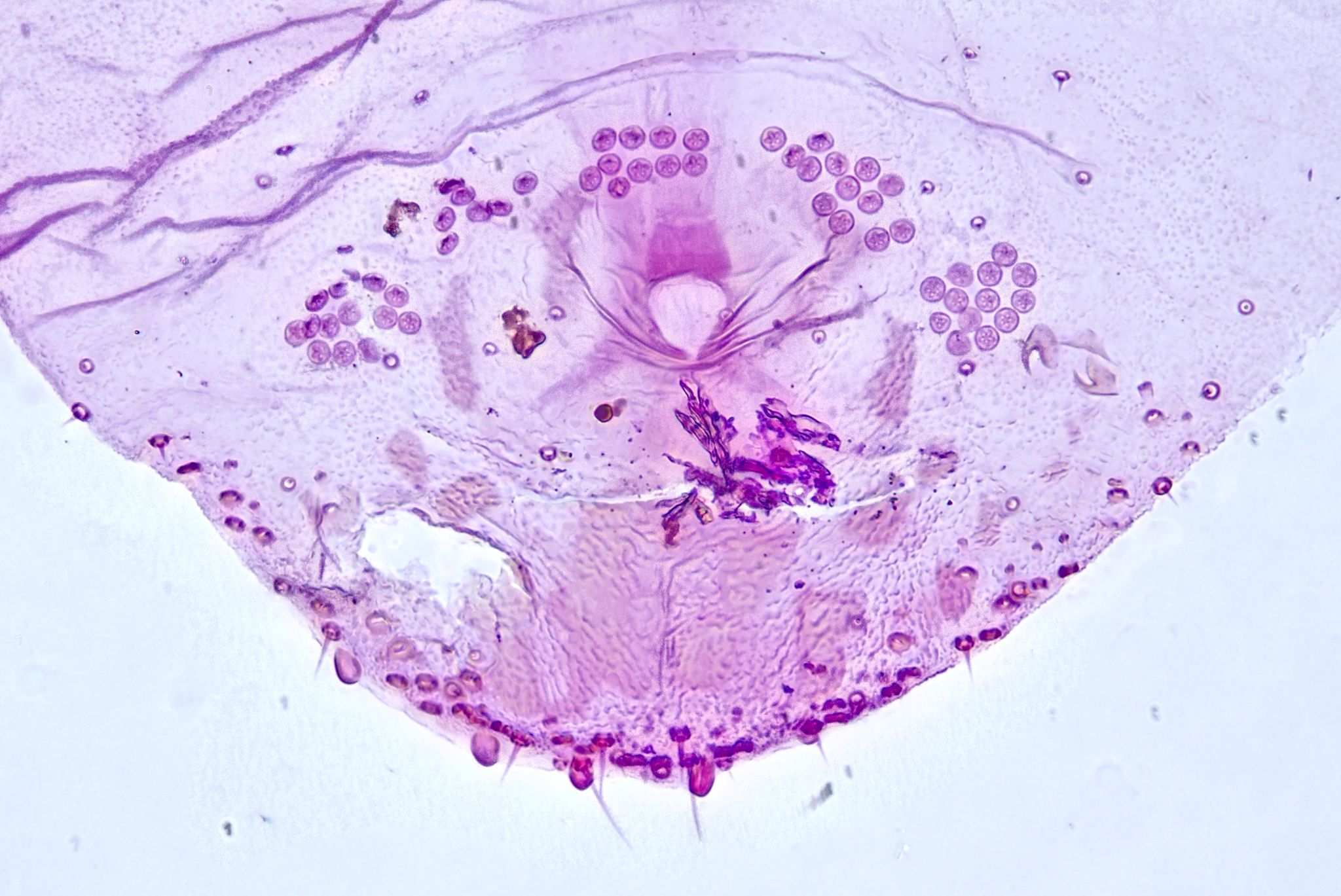 Leucaspis lowi