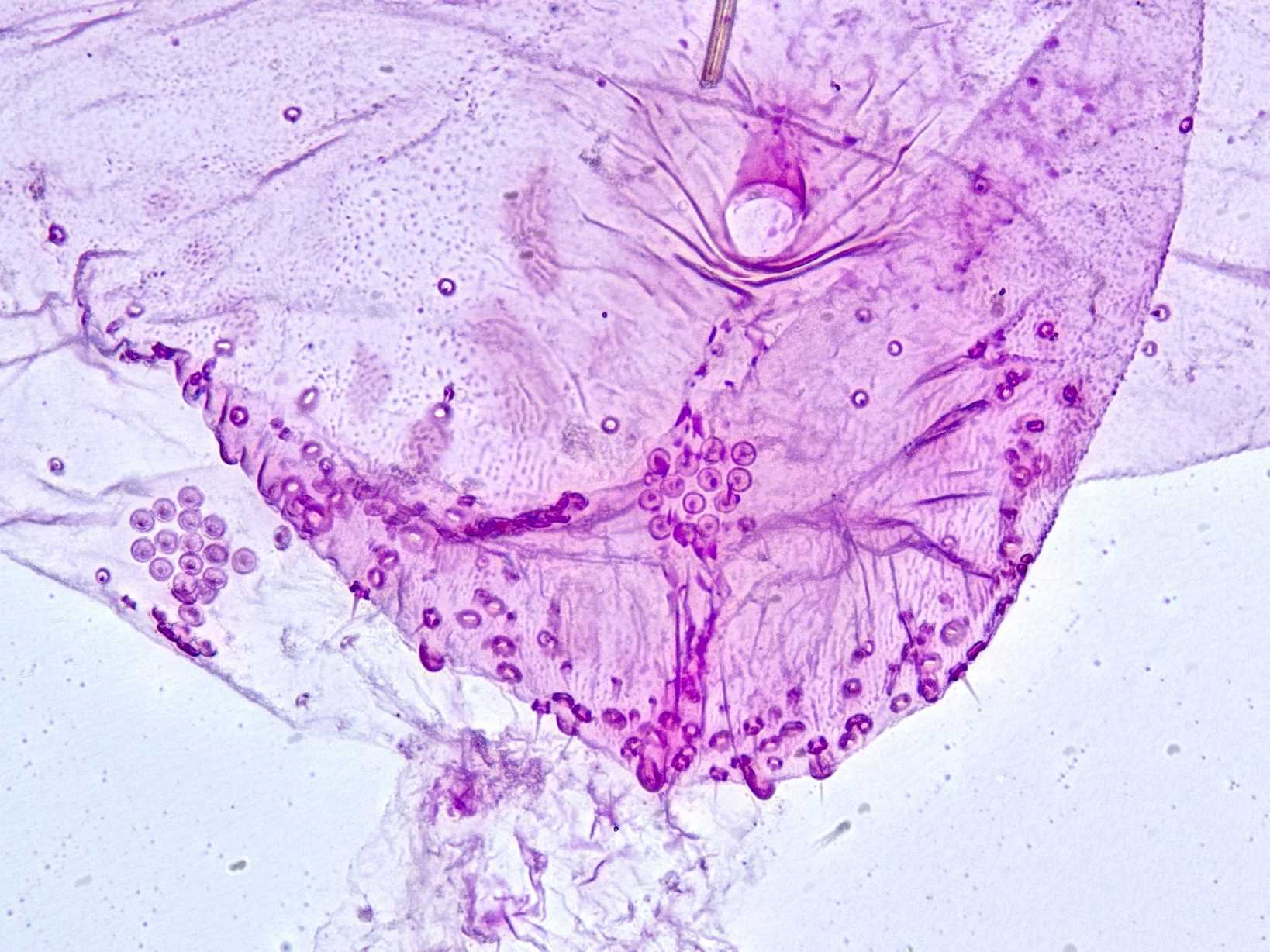 Leucaspis lowi