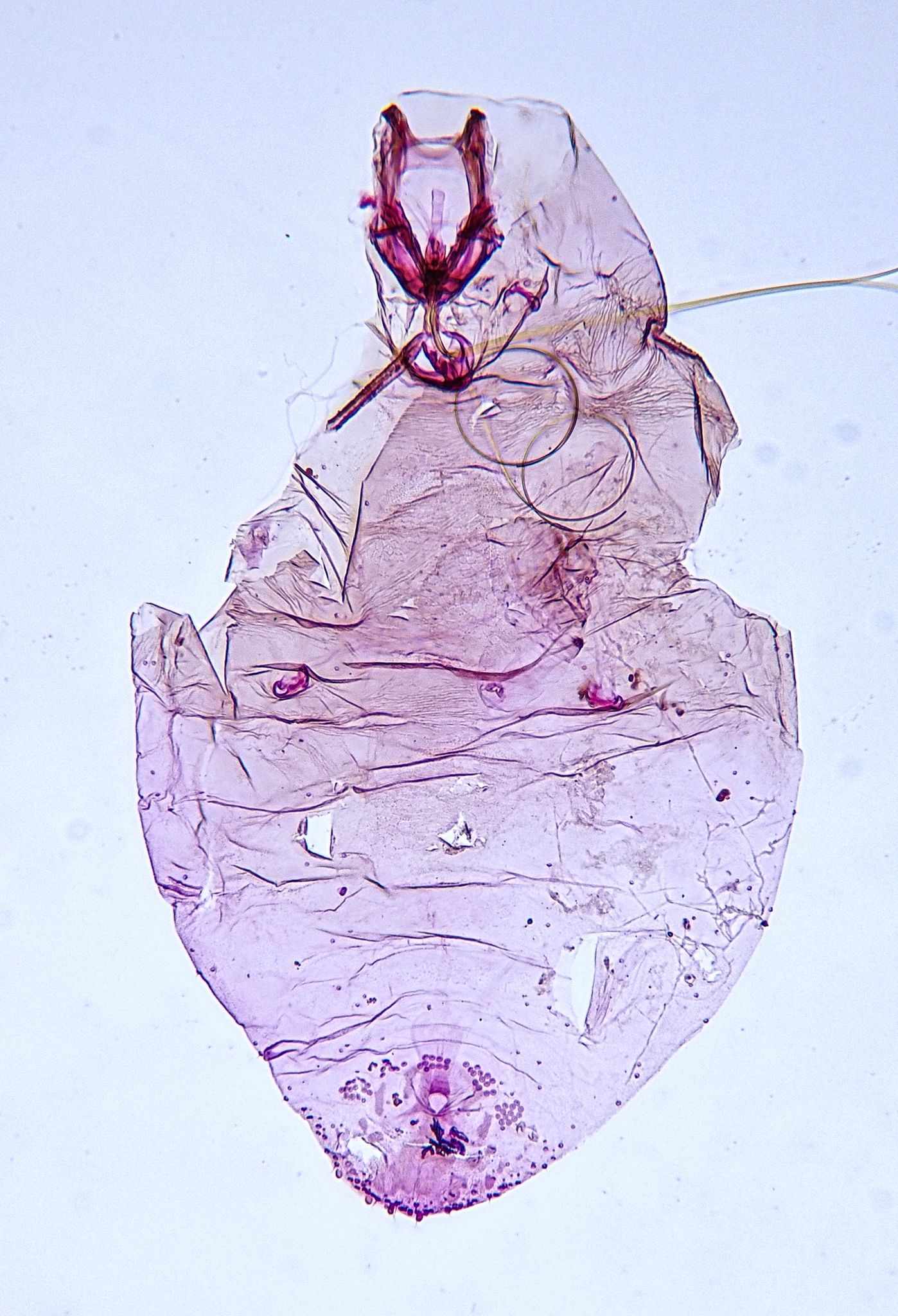 Leucaspis lowi