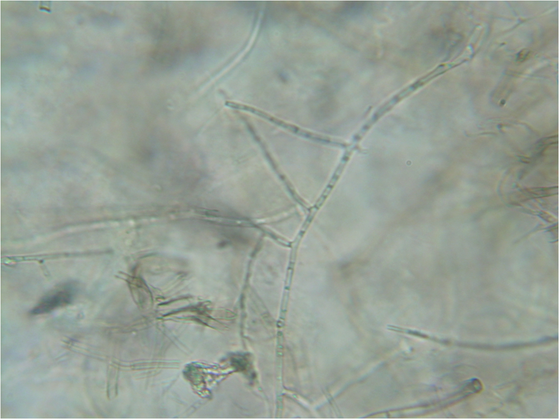 Rhizoctonia solani