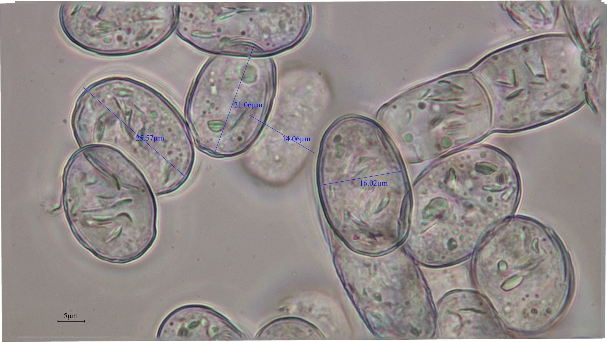Podosphaera leucotricha