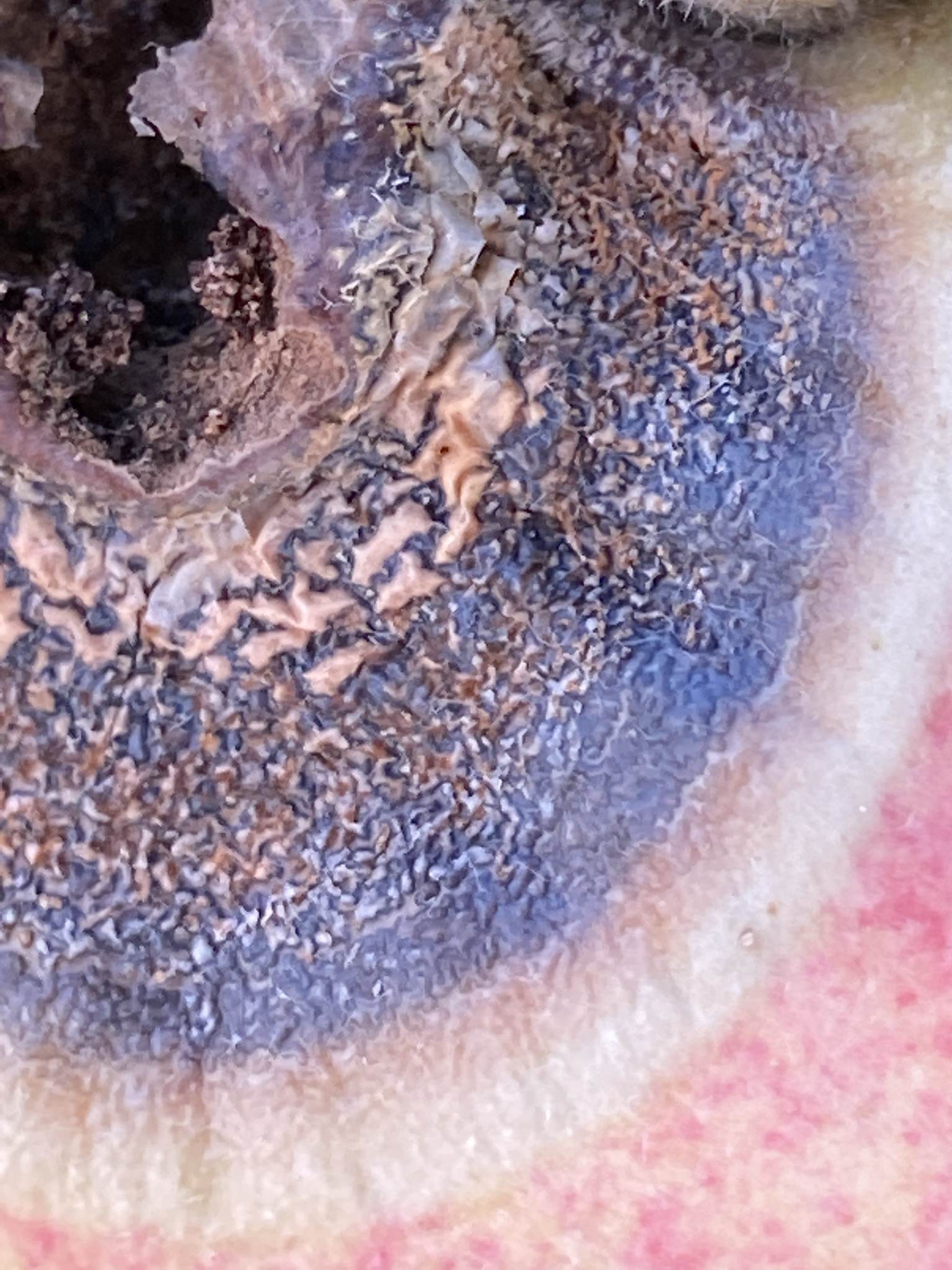 Neofabraea malicorticis