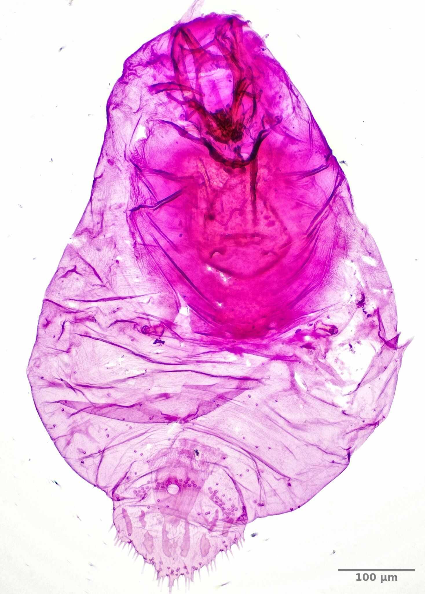Leucaspis pusilla