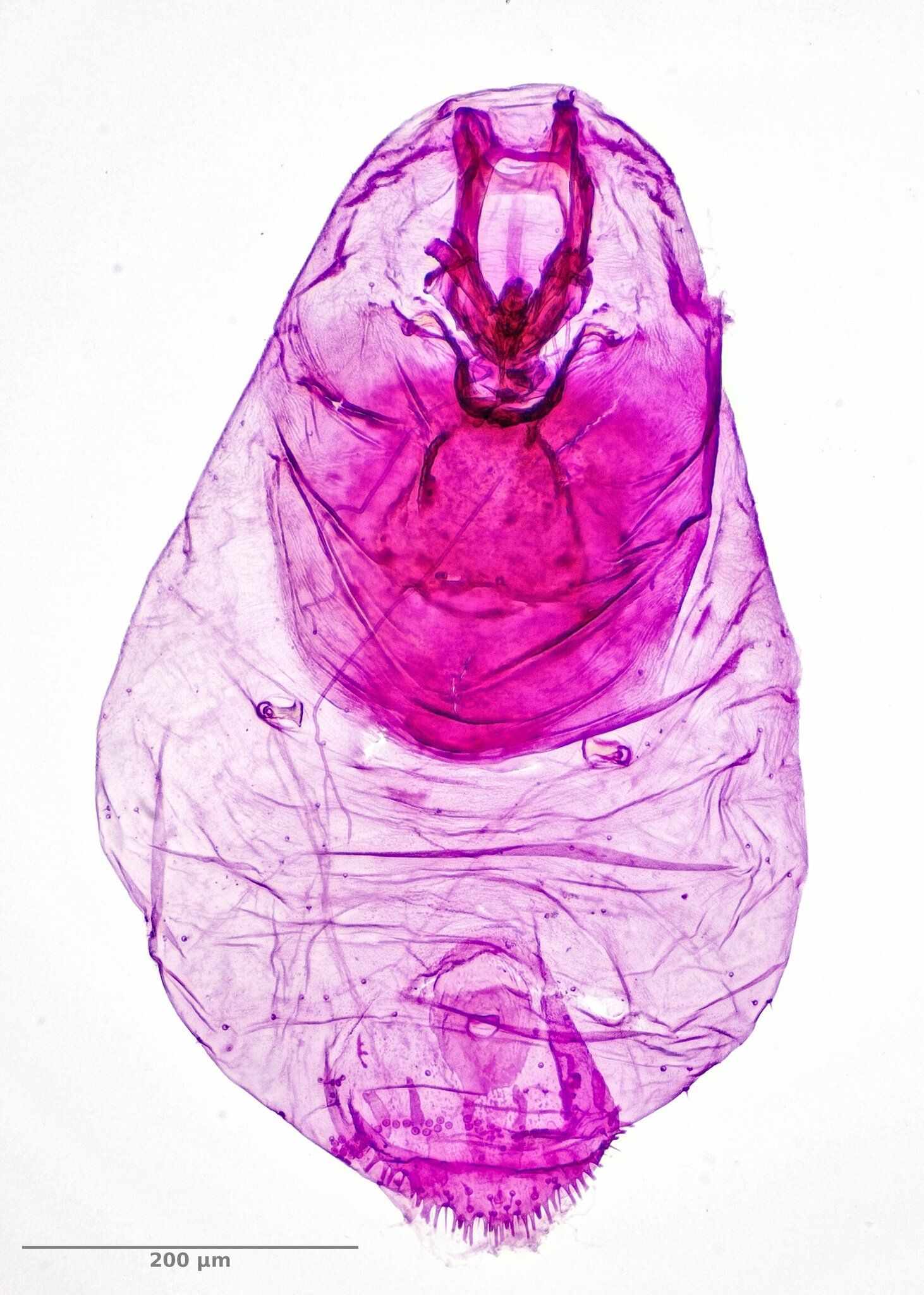 Leucaspis pusilla