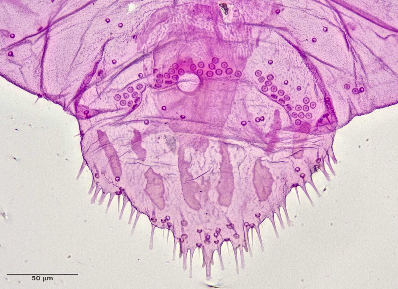 Leucaspis pusilla