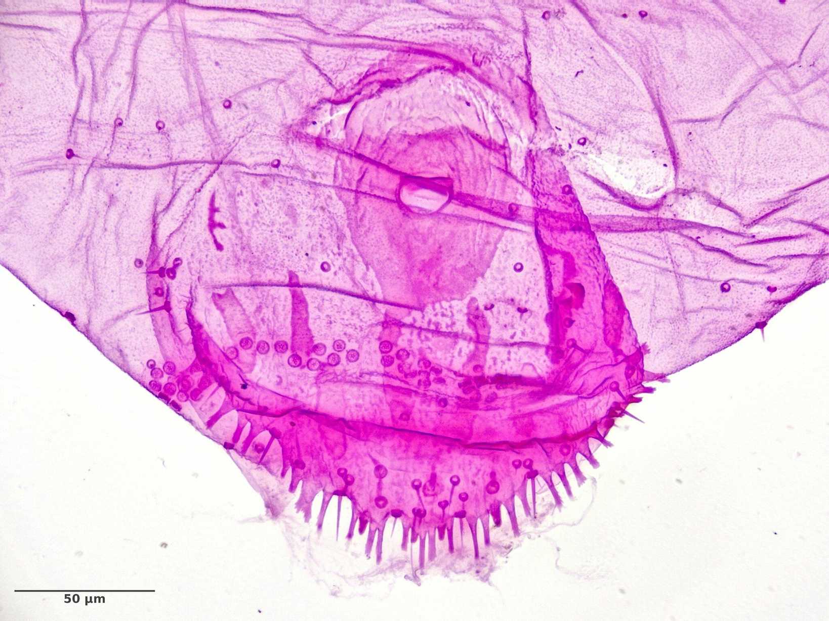 Leucaspis pusilla