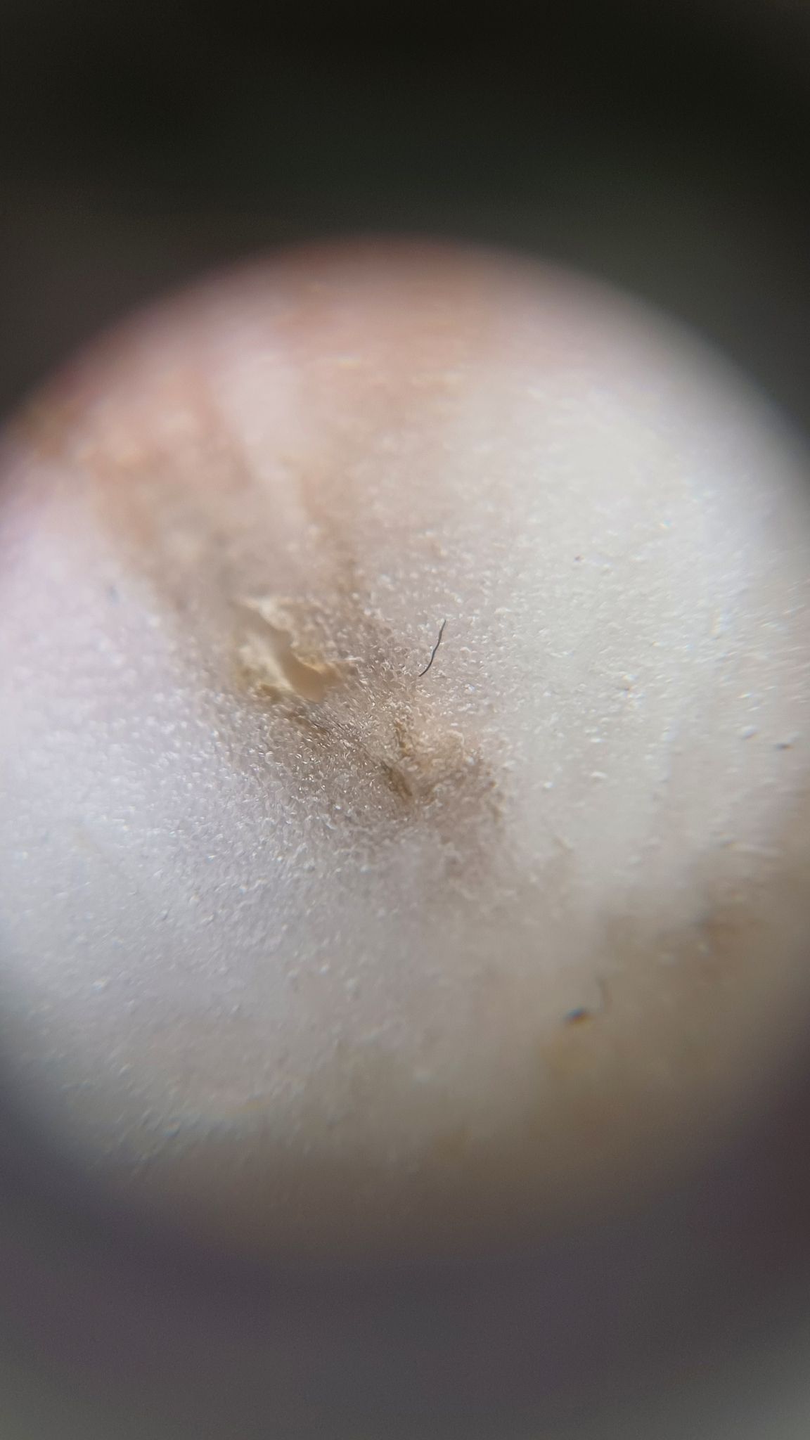 Aphanomyces raphani