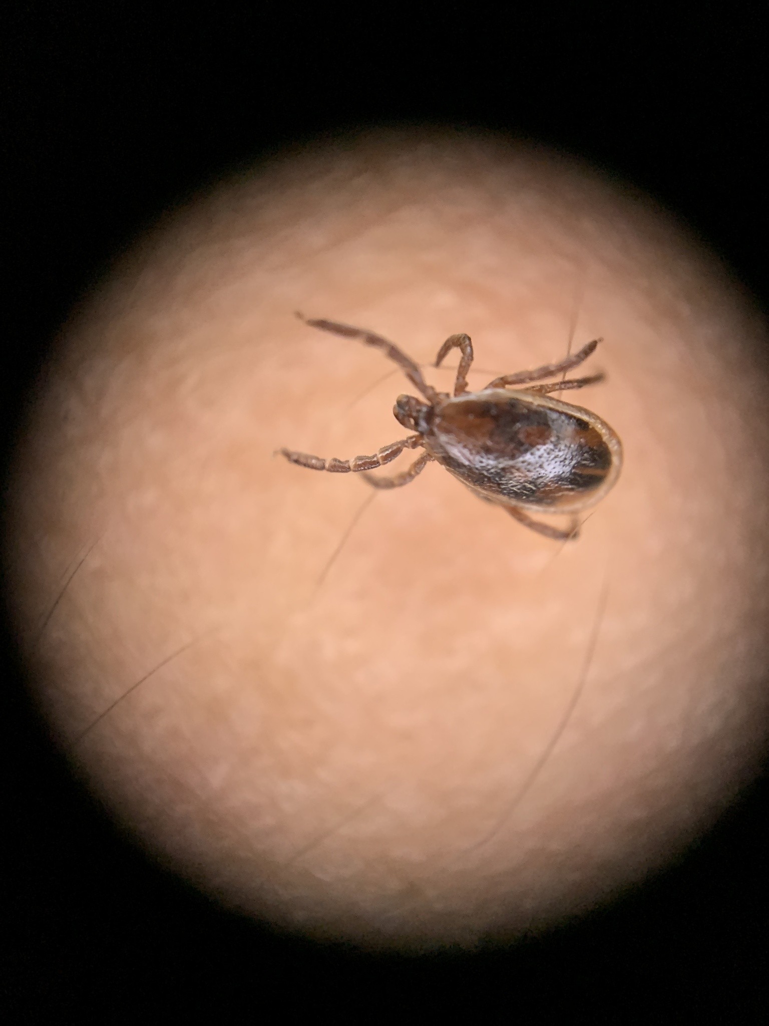 Ixodes