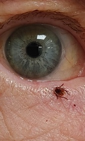 Ixodes