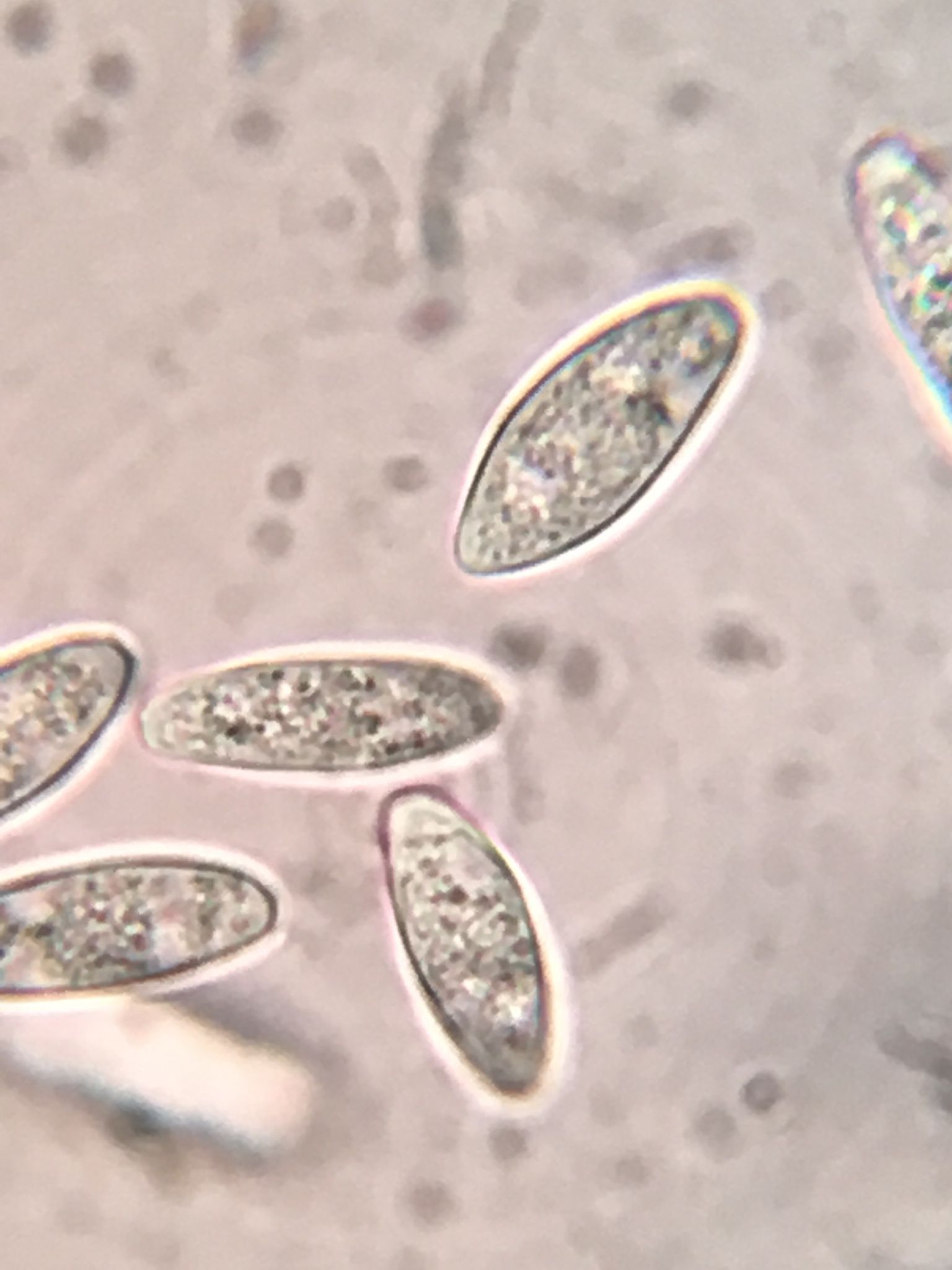 Neofusicoccum parvum