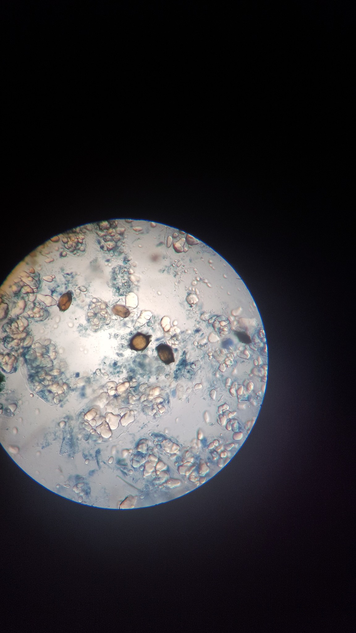 Synchytrium endobioticum