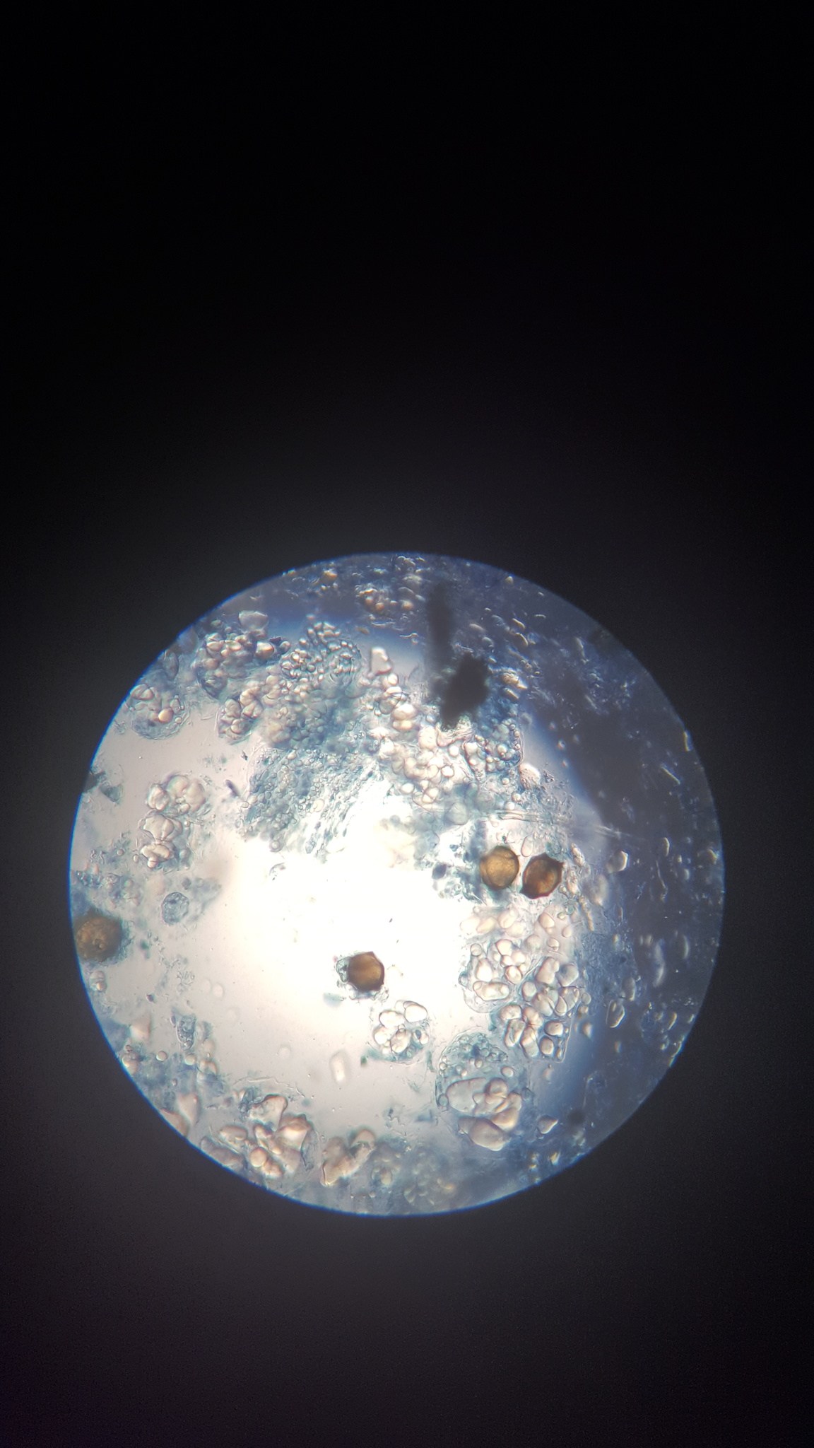 Synchytrium endobioticum